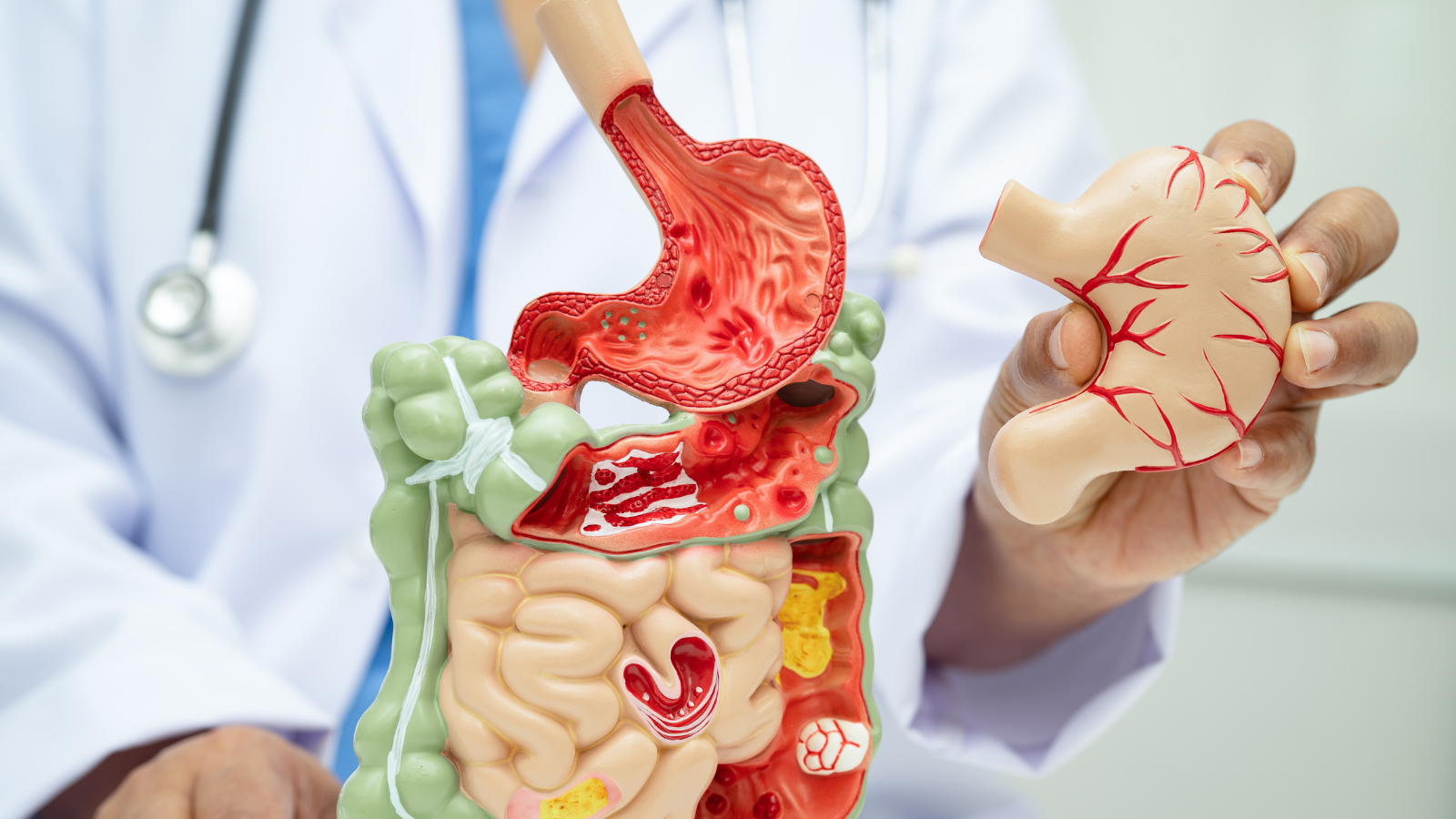 Lá mơ lông giúp bảo vệ niêm mạc dạ dày và giảm khó chịu sau ăn