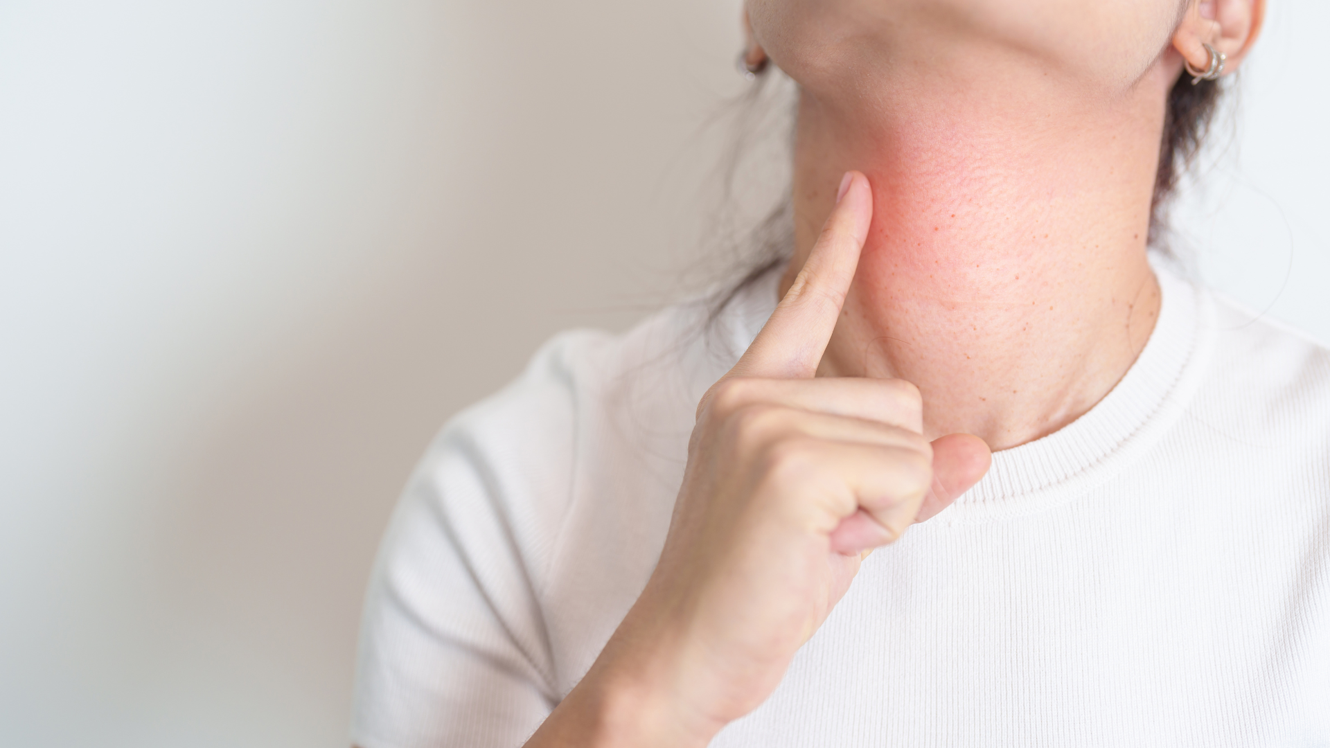 Khối u lành tính cần mổ khi gây đau, chèn ép, ảnh hưởng chức năng hoặc thẩm mỹ