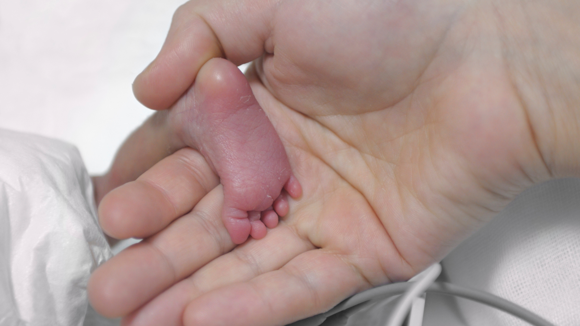 Chi phí nuôi trẻ sinh non thường cao hơn nhiều so với trẻ đủ tháng