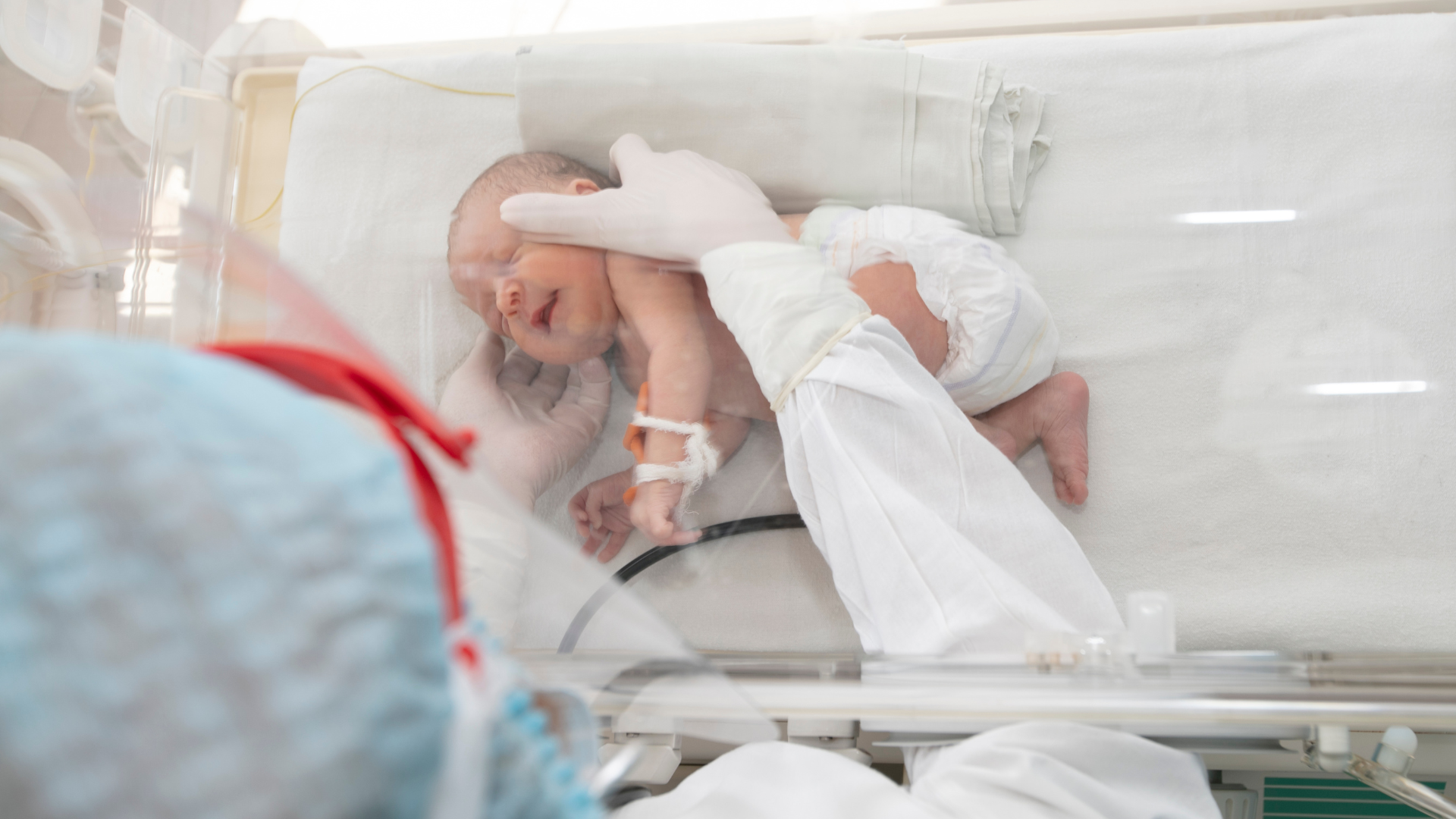 Trẻ sinh non thường phải nằm trong khoa hồi sức sơ sinh (NICU) từ vài tuần đến vài tháng