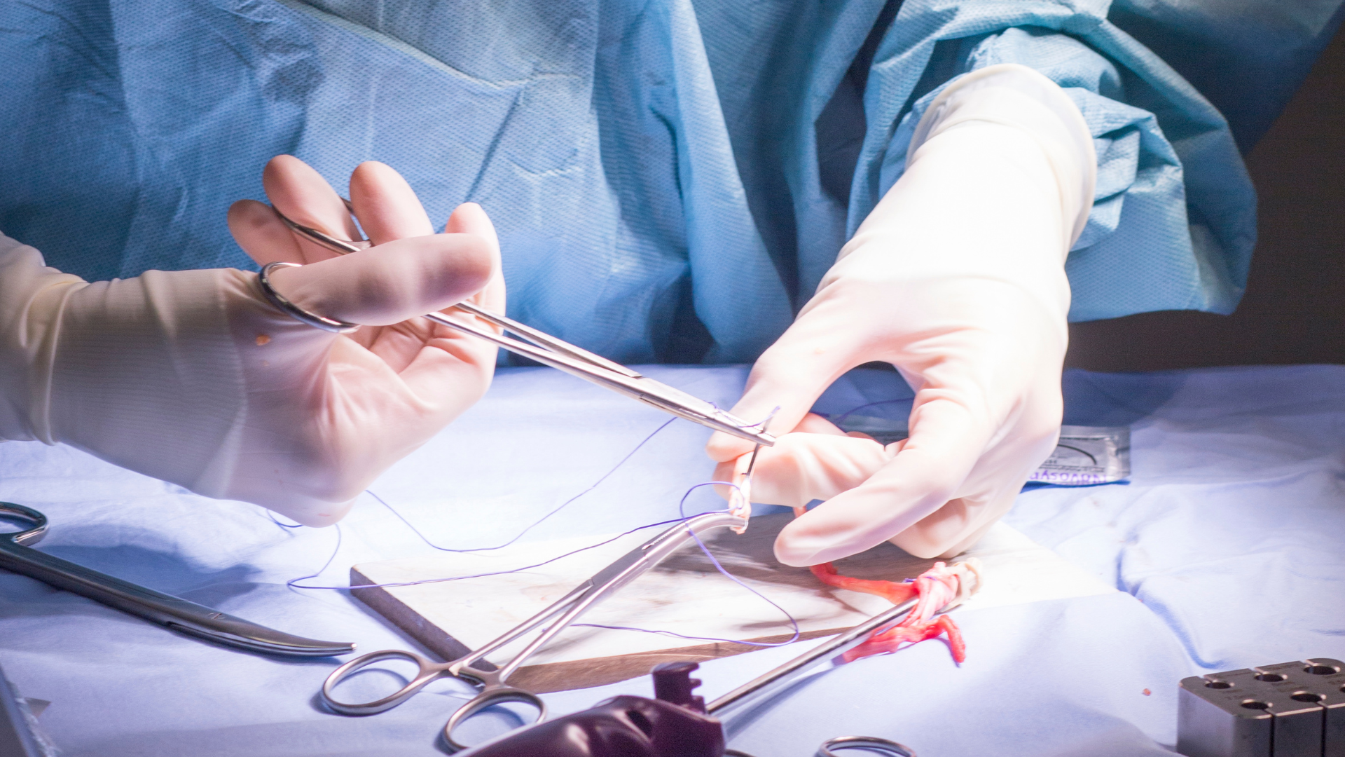 Phẫu thuật đứt dây chằng đầu gối bao nhiêu tiền? Đây là câu hỏi nhiều người quan tâm