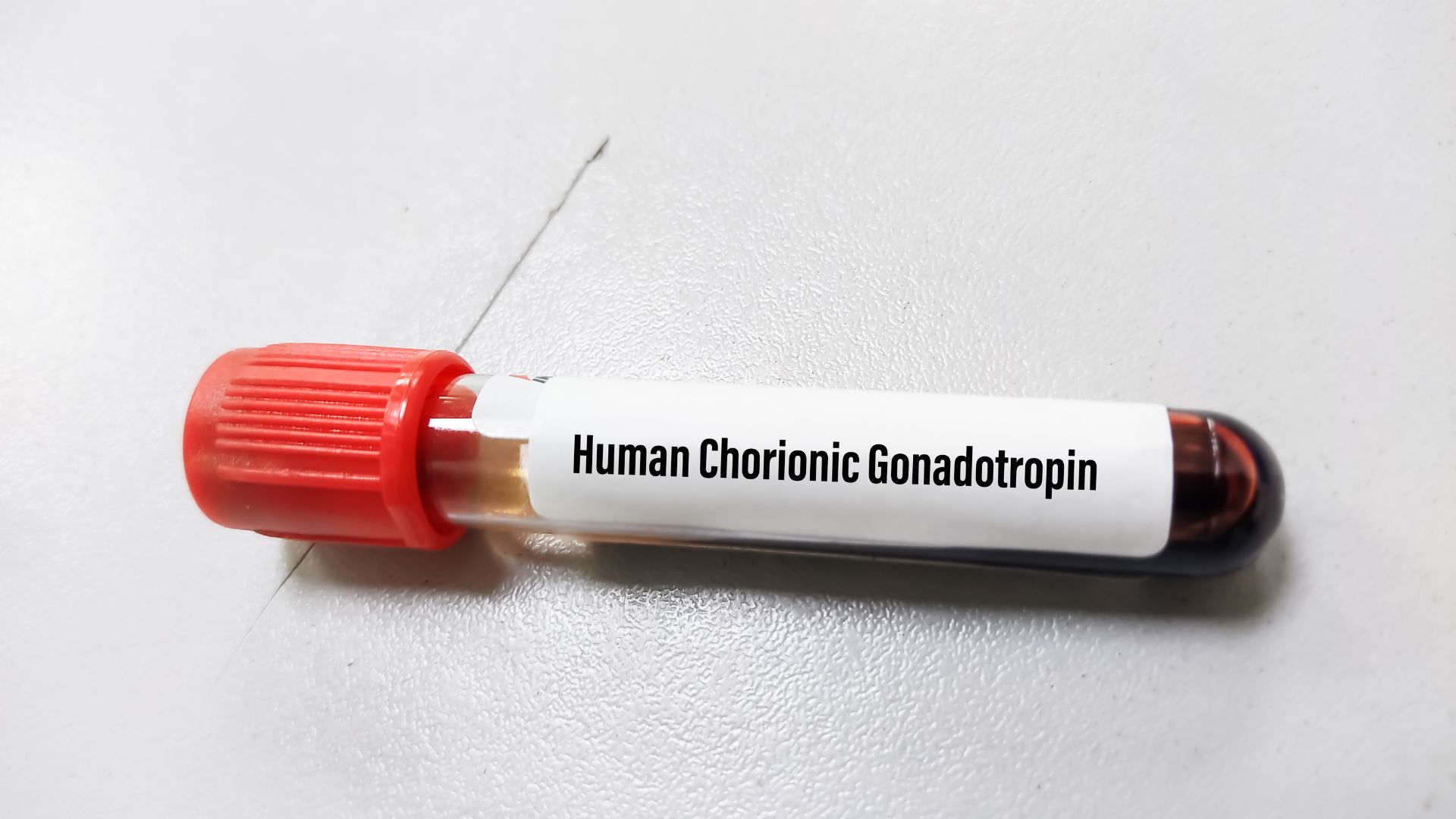 Chỉ số beta bao nhiêu là có thai? Thực hiện xét nghiệm beta bằng cách nào? 1