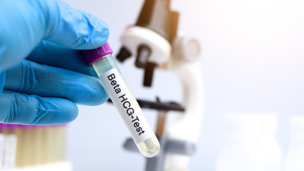 Chỉ số beta hCG của người bình thường thường ở mức rất thấp