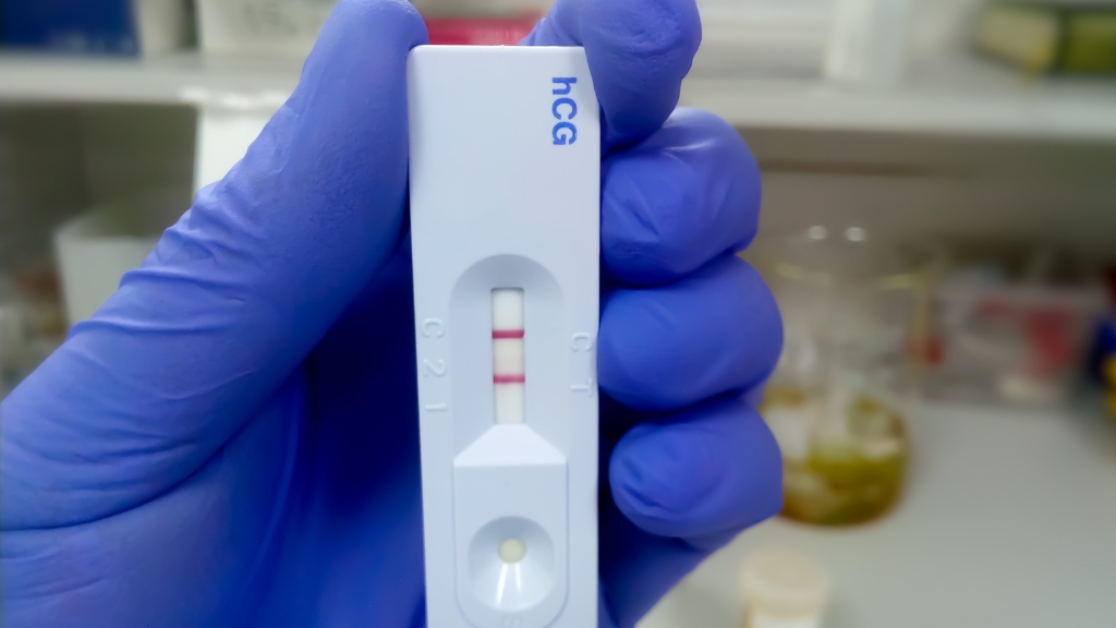 Beta hCG giúp phát hiện thai sớm và theo dõi diễn tiến thai kỳ qua xu hướng thay đổi