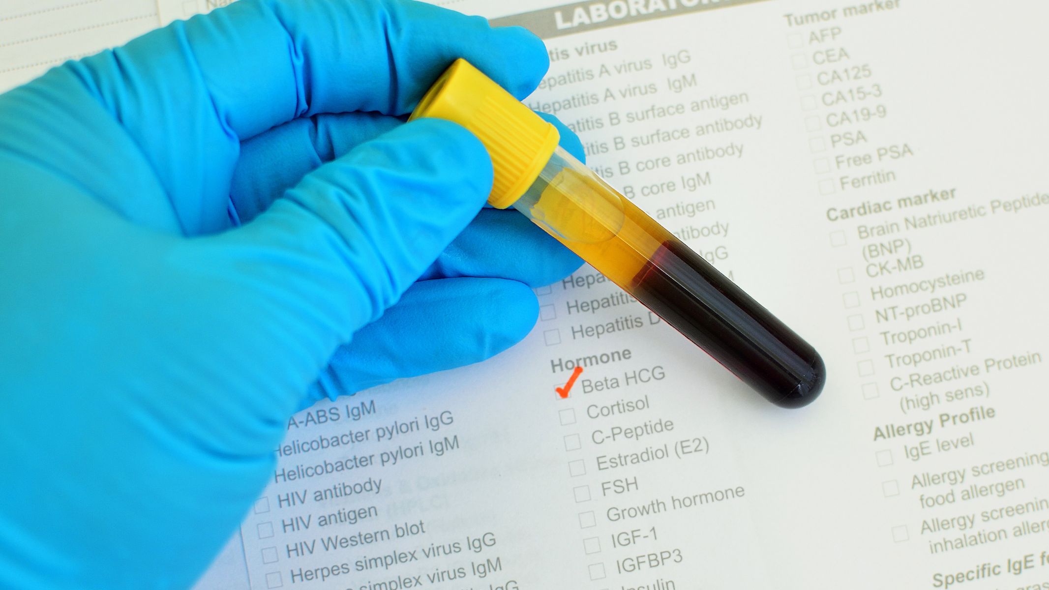 Beta tăng chậm sau chuyển phôi có sao không?