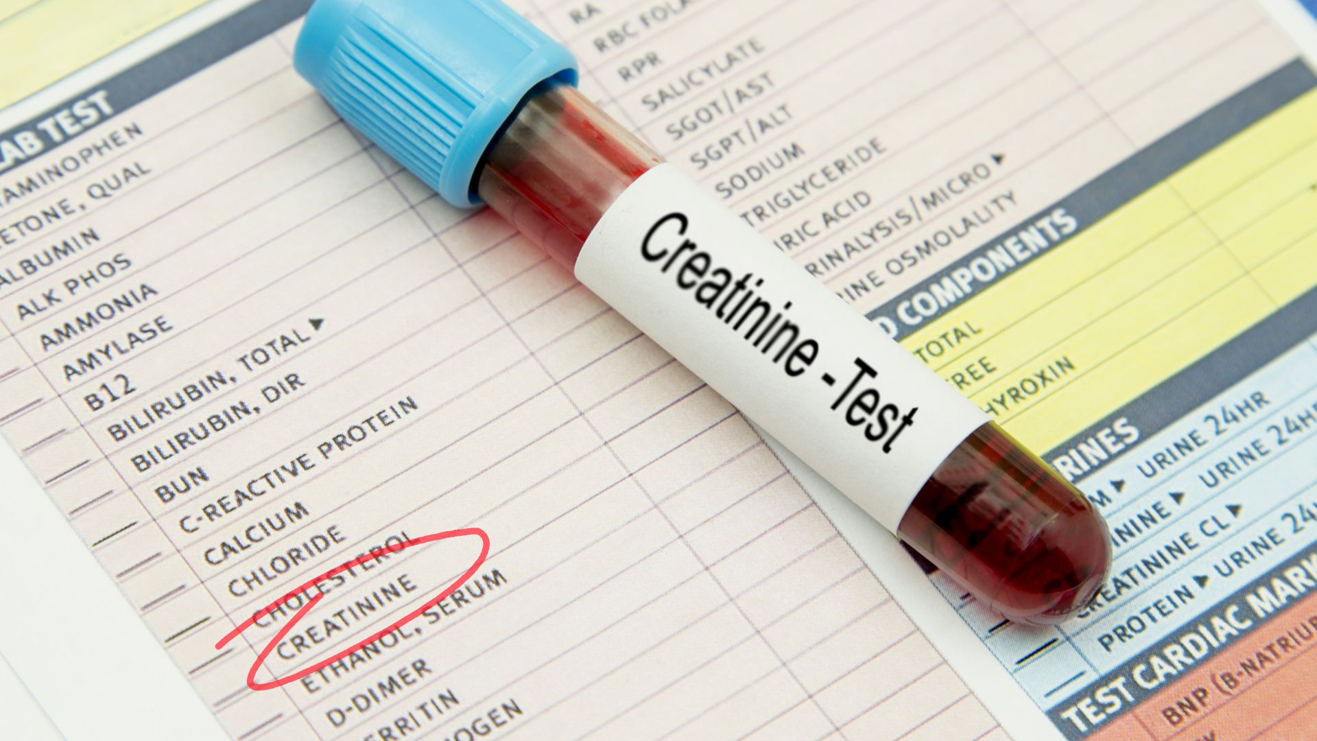 Chỉ số creatinin bao nhiêu thì phải chạy thận