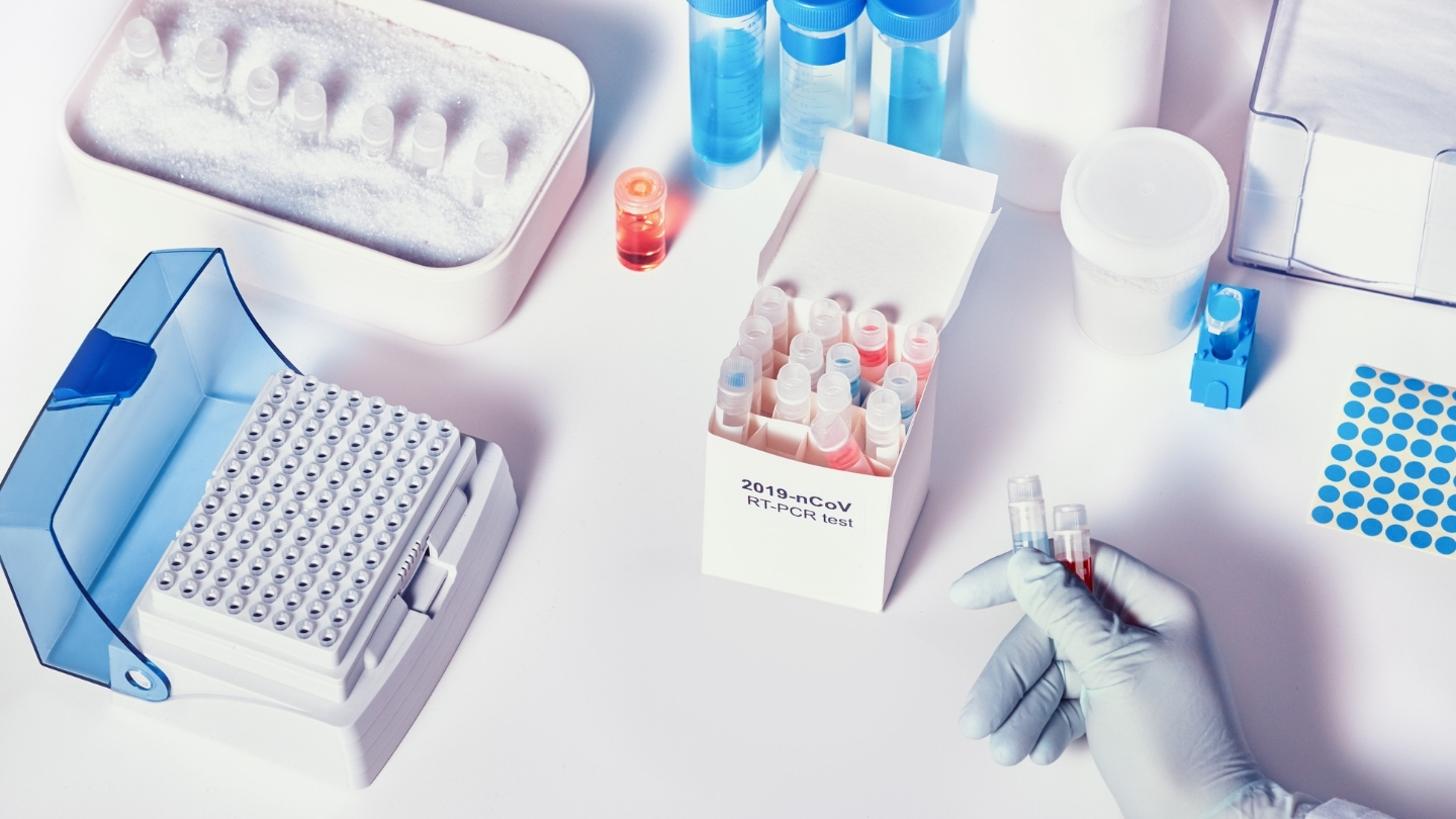 Chỉ số CT từ 35 trở lên thường được xem là âm tính