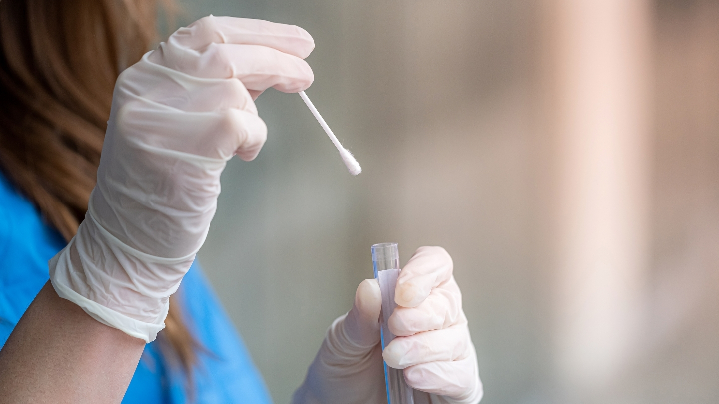 Việc lấy mẫu không đúng kỹ thuật hoặc từ vị trí không phù hợp có thể làm giảm lượng virus thu được