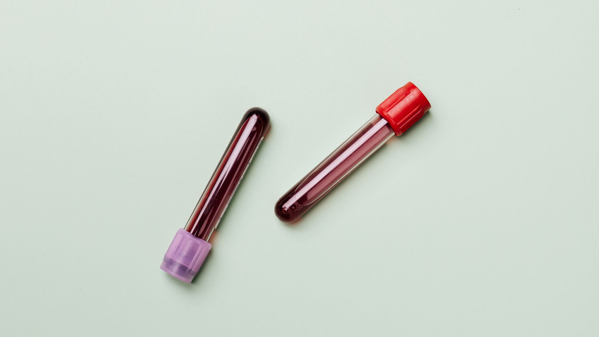 Xét nghiệm kiểm tra men gan là việc làm cần thiết khi có chỉ số đàn hồi gan ở ngưỡng f0 - 1