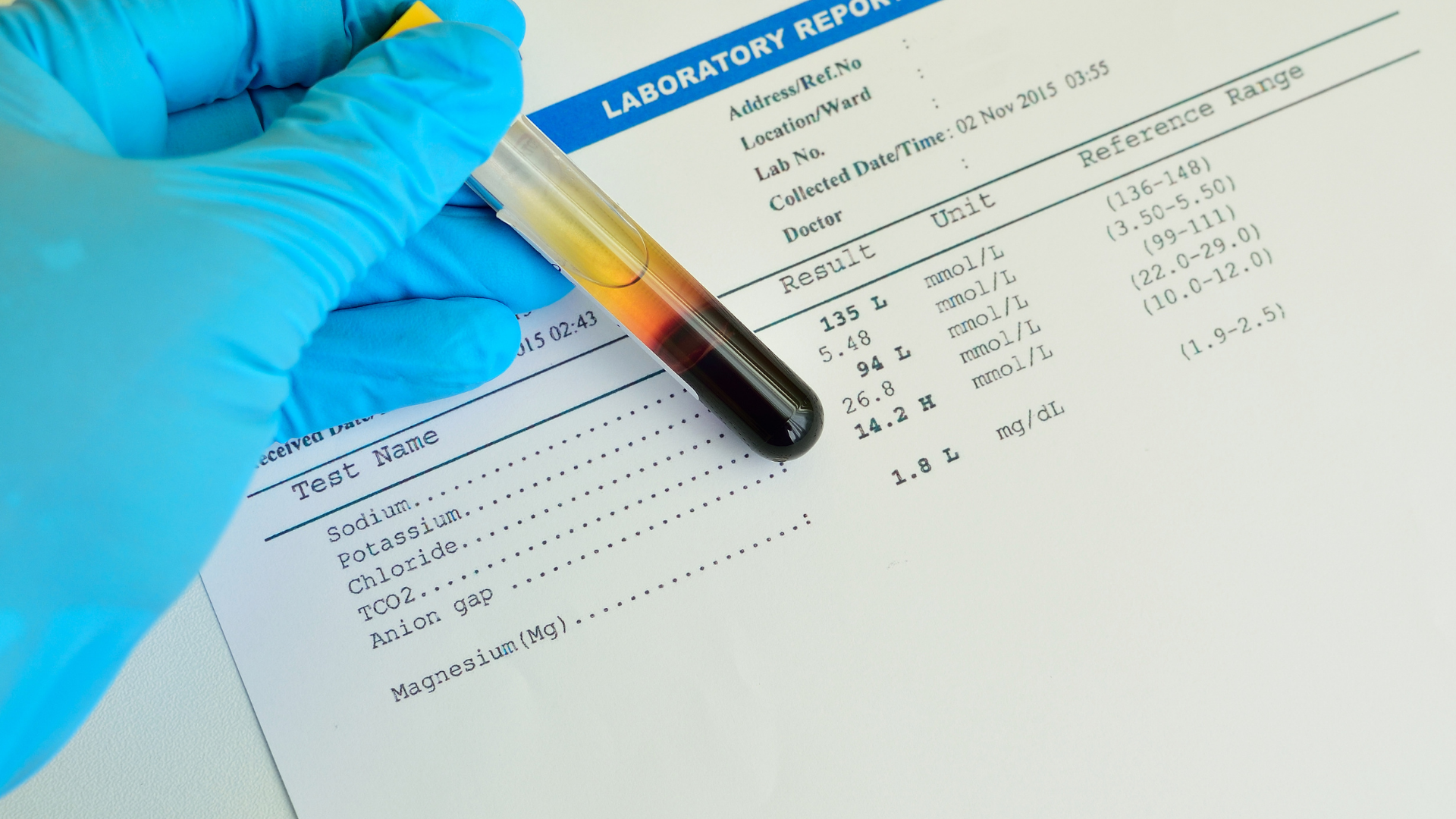 Chỉ số điện giải Na⁺ là yếu tố quan trọng của bảng điện giải