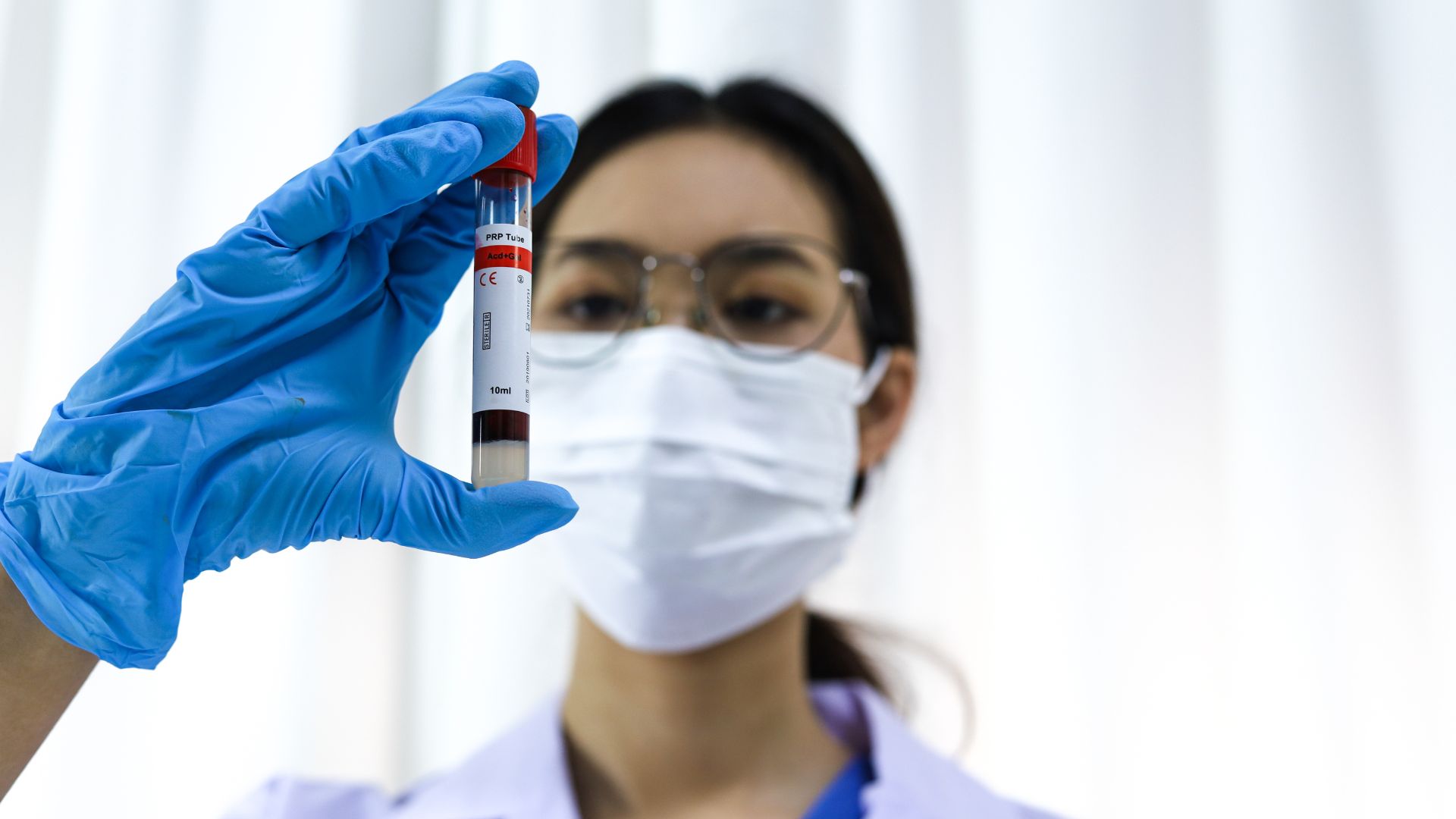 Đường huyết thường tăng sau bữa ăn và đạt đỉnh khoảng 1 - 2 giờ sau đó