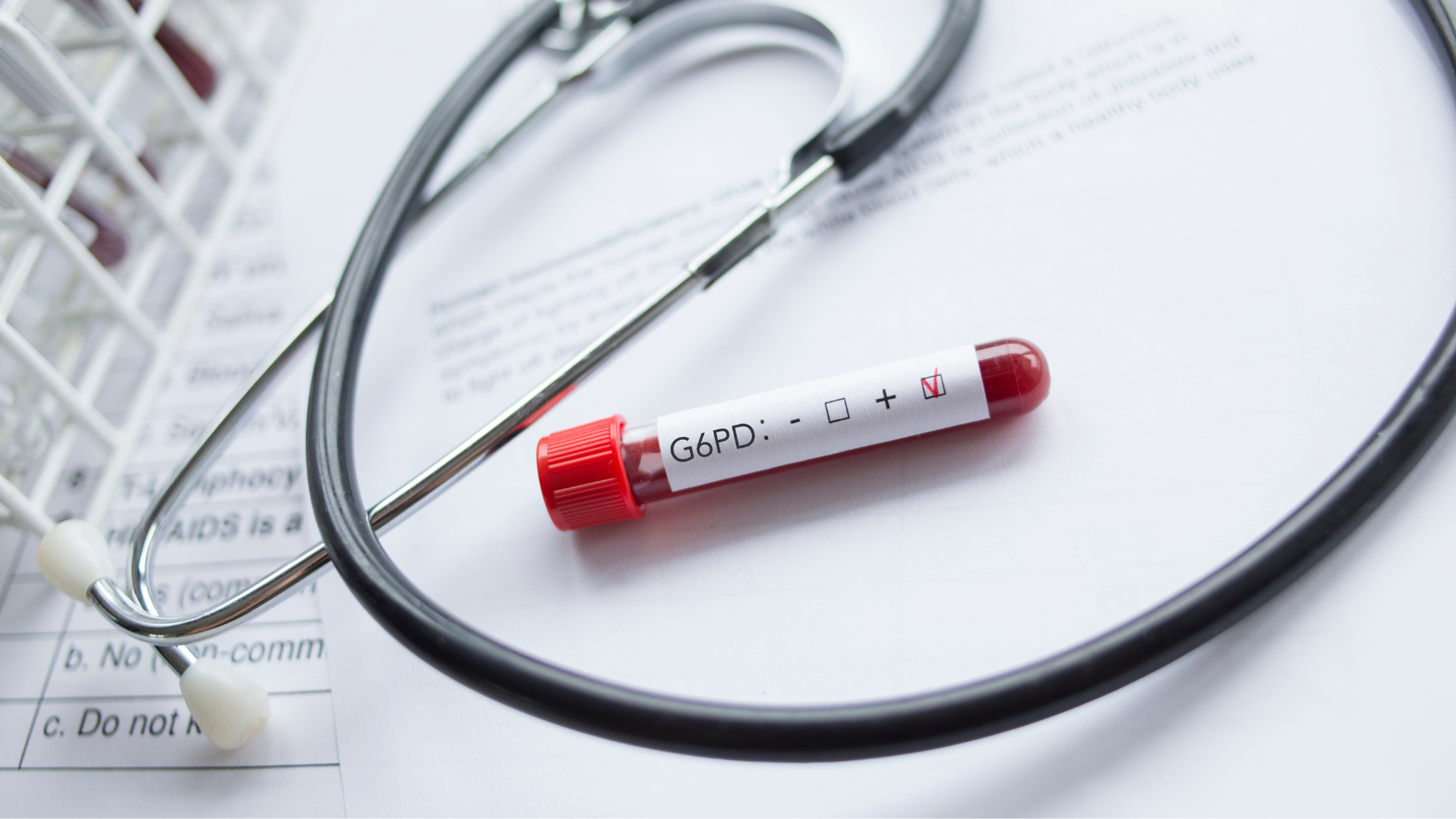 Xét nghiệm G6PD đánh giá tình trạng thiếu men G6PD