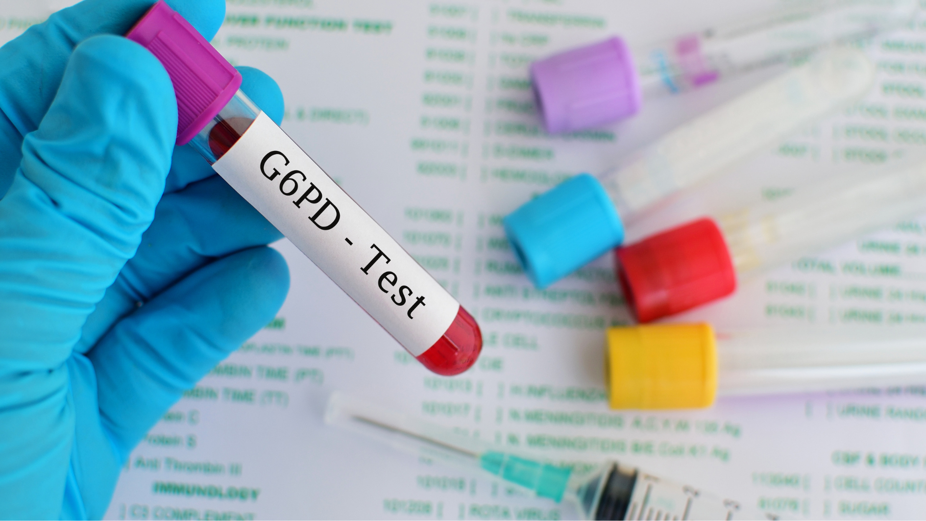 Chỉ số G6PD bao nhiêu là bình thường được nhiều phụ huynh quan tâm