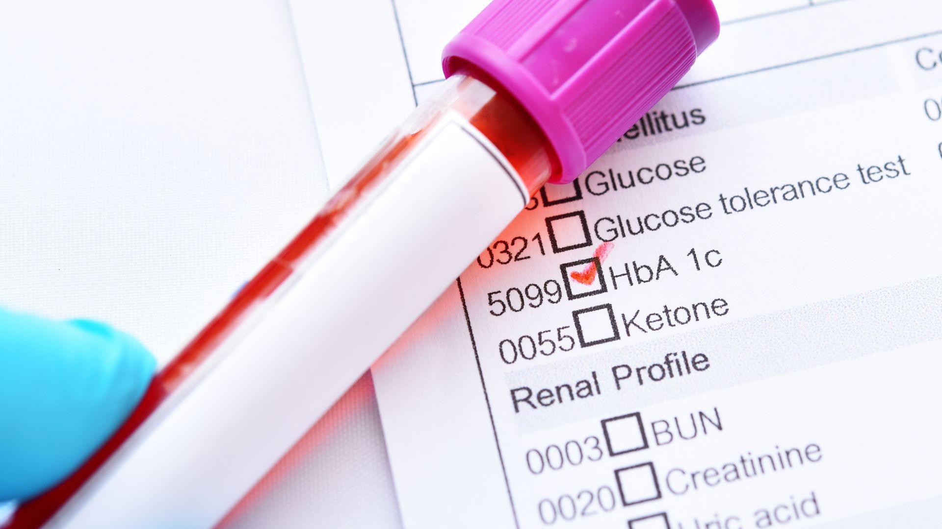 Chỉ số HbA1c bao nhiêu là bị tiểu đường? Hướng dẫn hiểu đúng và phòng ngừa hiệu quả 2