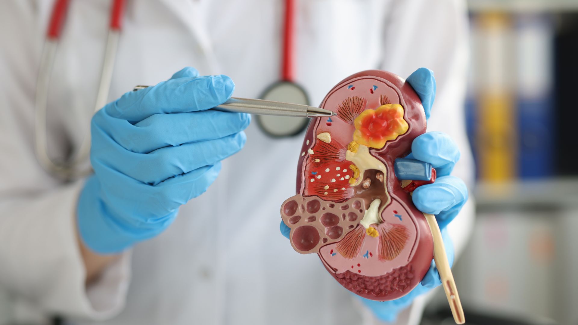 Chỉ số HbA1c bao nhiêu là bị tiểu đường? Hướng dẫn hiểu đúng và phòng ngừa hiệu quả 5