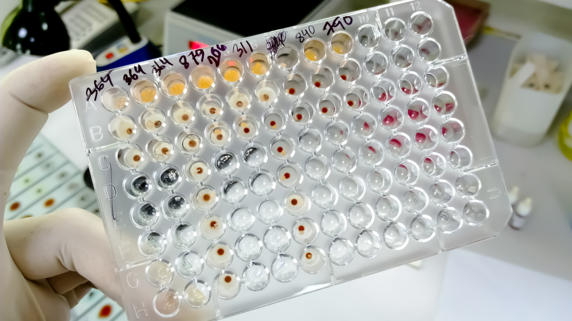 Xét nghiệm ELISA là phương pháp phổ biến để định lượng kháng thể