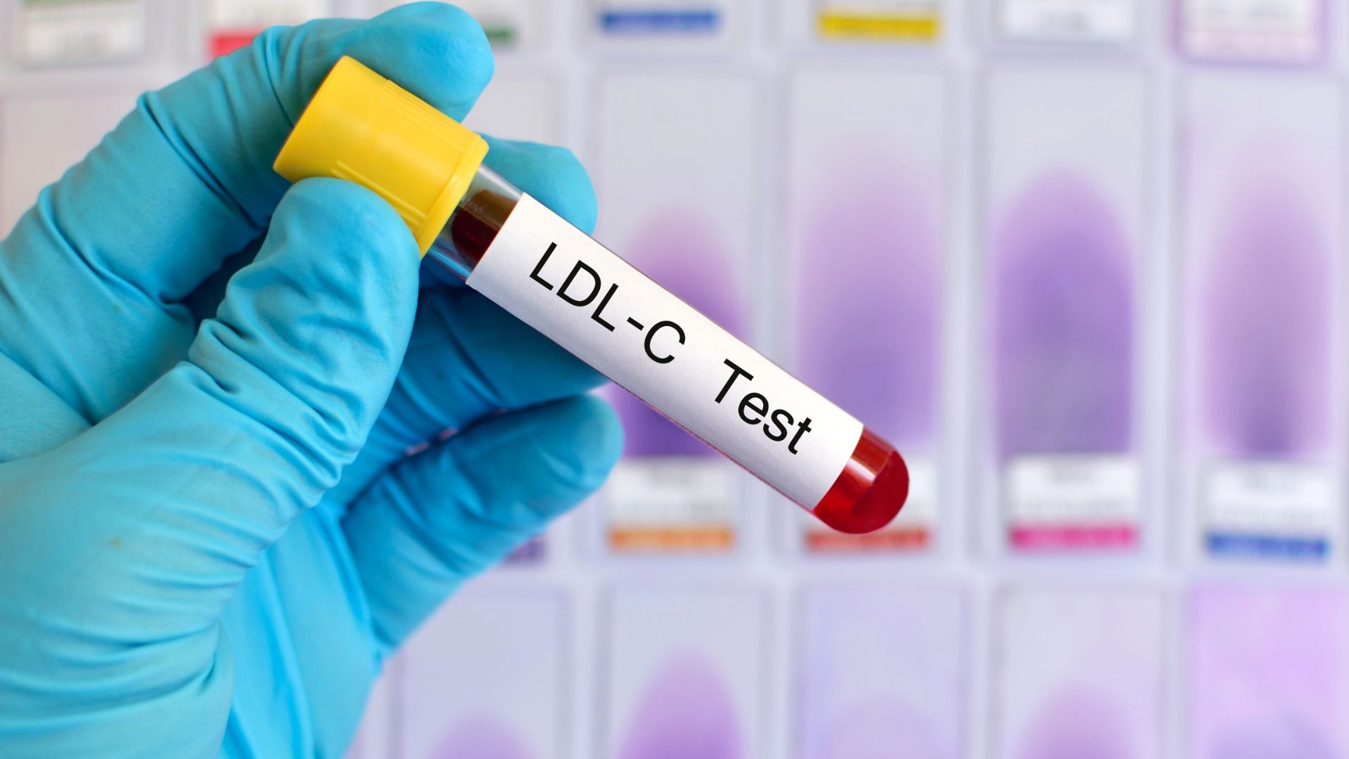Người lớn khỏe mạnh nên giữ LDL dưới 100 mg/dL