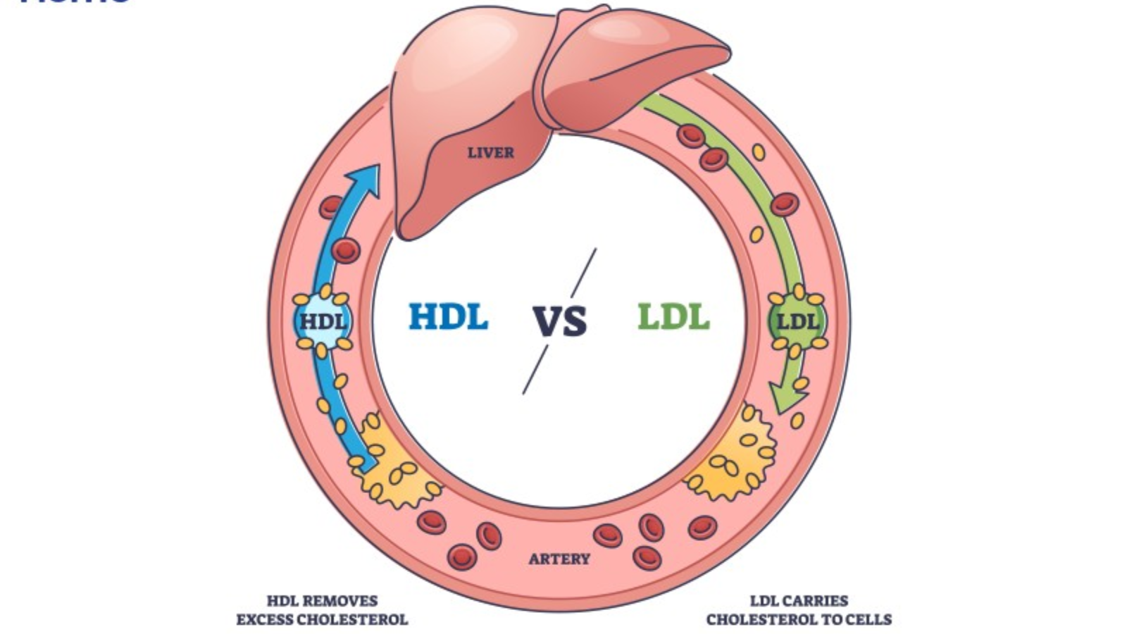 HDL-C là cholesterol tốt, còn LDL-C thì ngược lại