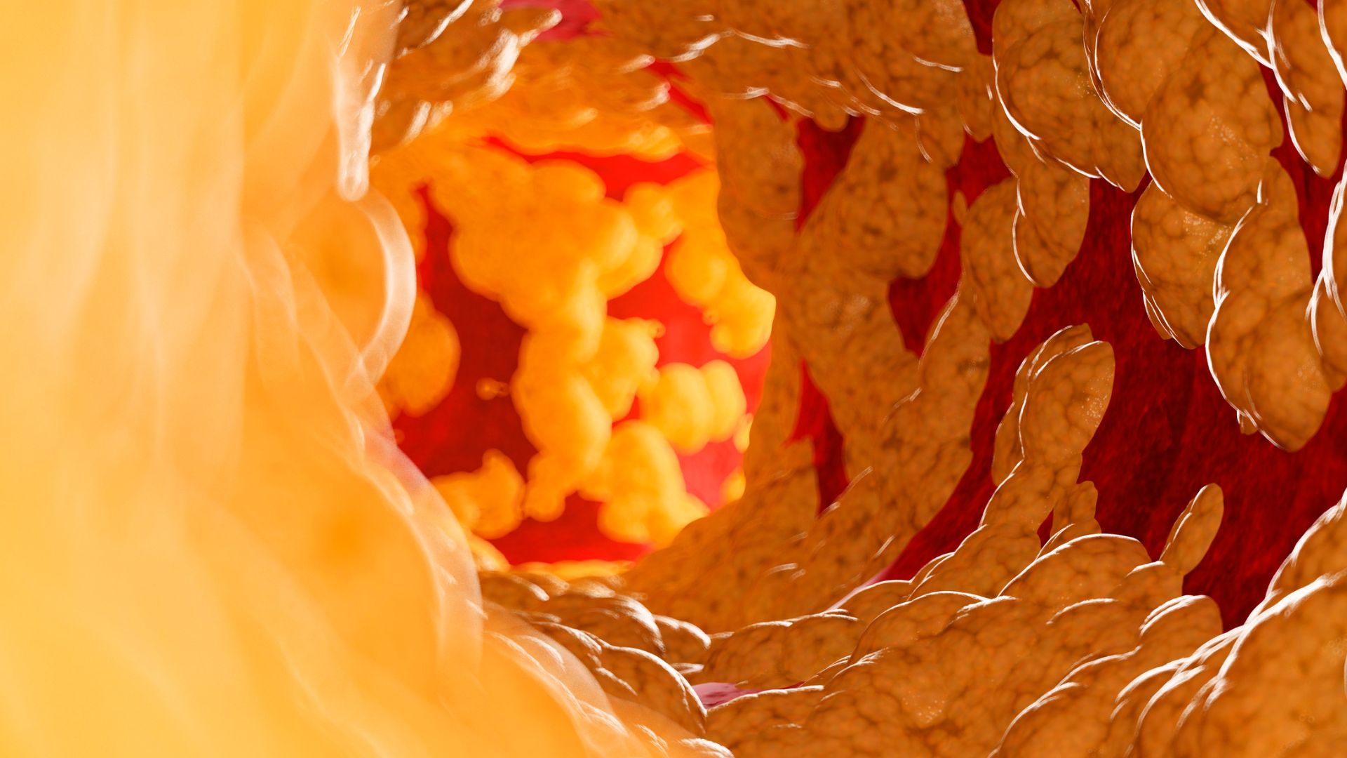 Chỉ số mỡ nội tạng chuẩn là thước đo lượng mỡ tích tụ quanh các cơ quan trong ổ bụng