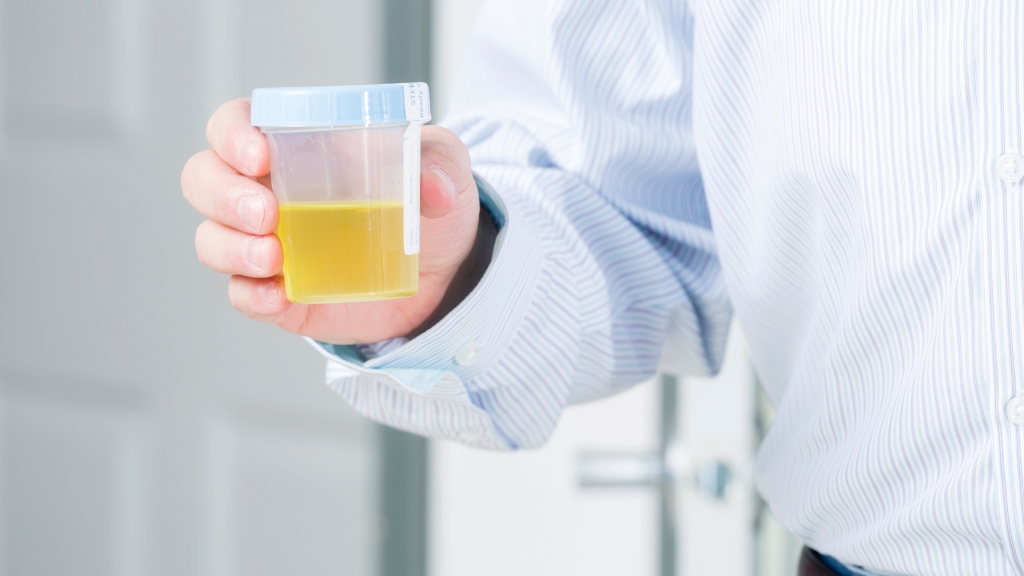 Quy trình lấy mẫu nước tiểu đúng cách giúp đảm bảo kết quả pH chính xác