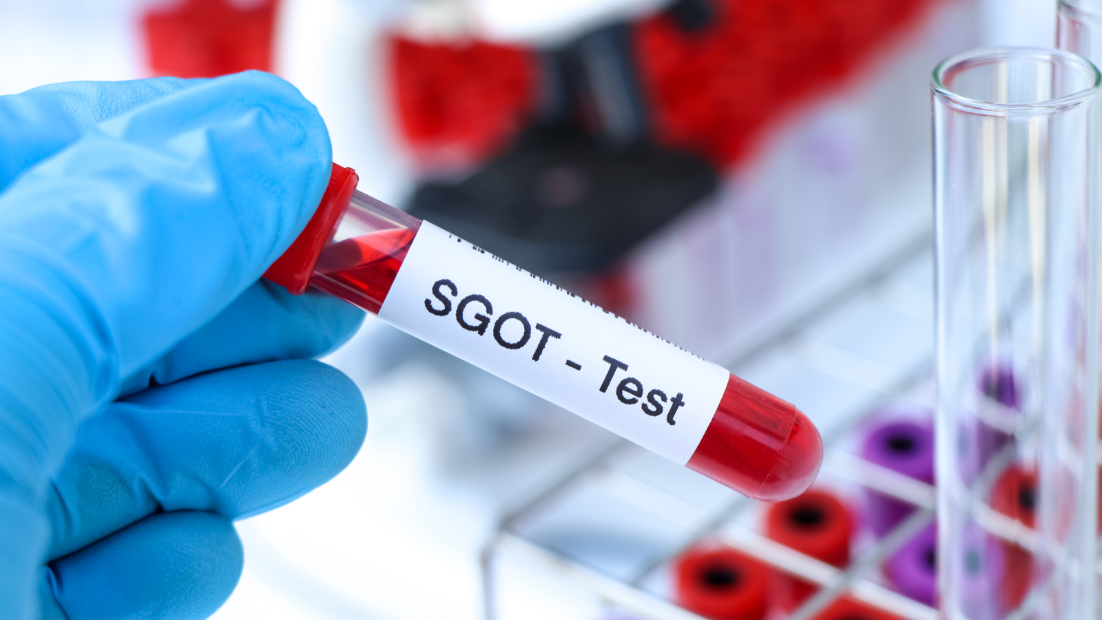 Chỉ số SGOT trong xét nghiệm máu là gì​?