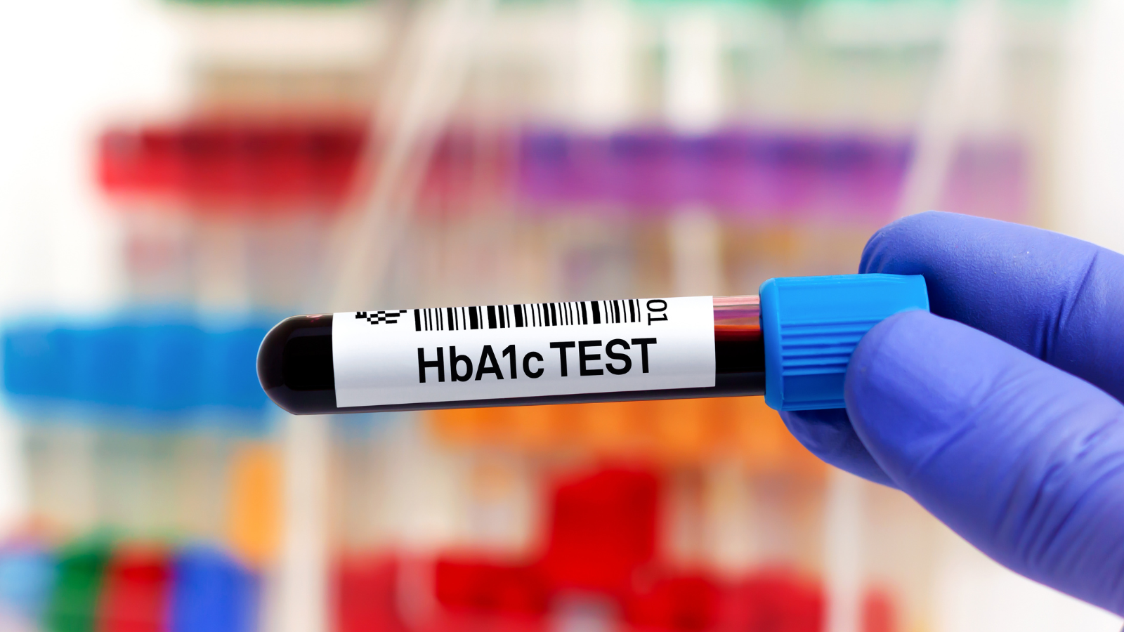 HbA1c cao kéo dài làm tăng nguy cơ biến chứng mạn tính