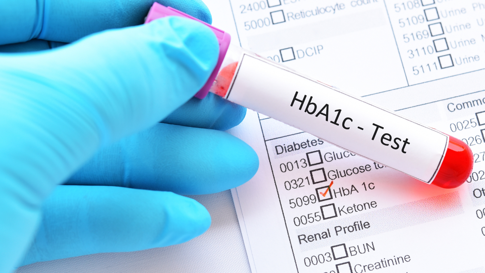 HbA1c là chỉ số quan trọng để xác định chỉ số tiểu đường bao nhiêu thì phải uống thuốc