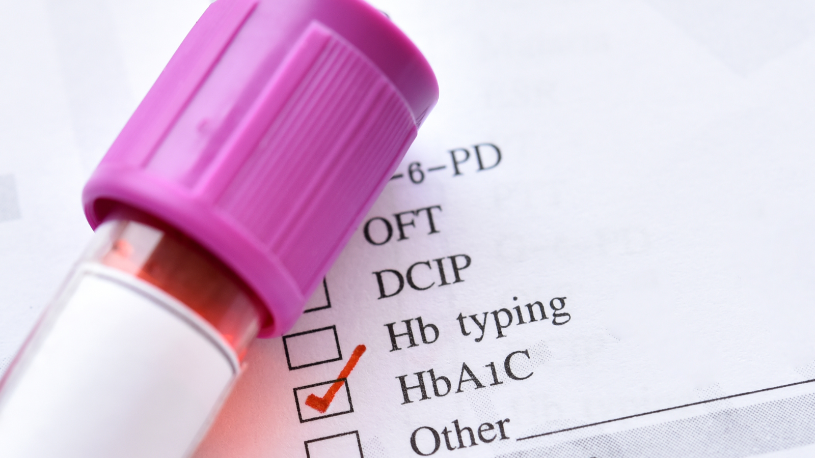 Kết hợp nhiều chỉ số giúp xác định chính xác thời điểm cần uống thuốc tiểu đường