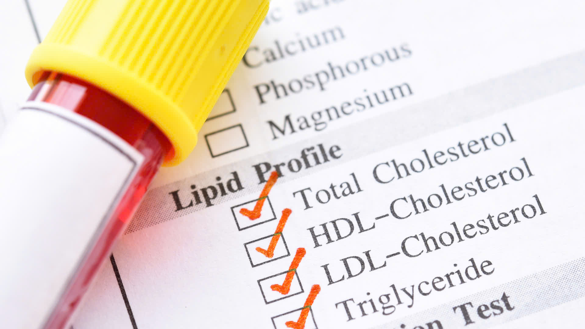 Chỉ số triglyceride bao nhiêu là cao?