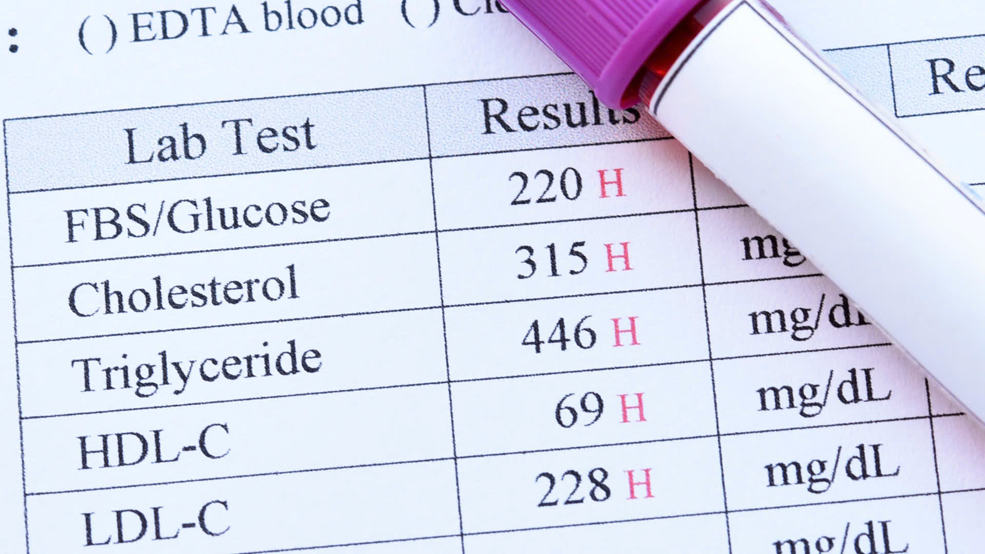 Chỉ số triglyceride cao có nguy hiểm không?
