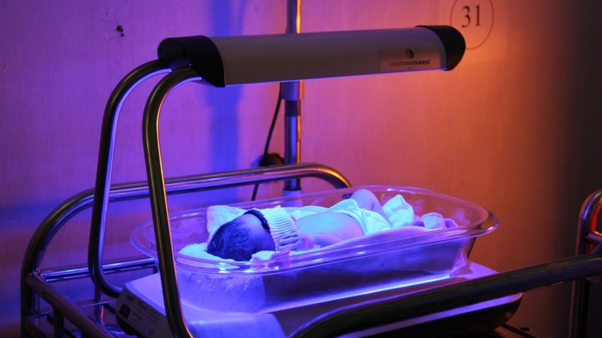 Trẻ sơ sinh cần thực hiện chiếu đèn vàng da nếu nồng độ bilirubin vượt ngưỡng an toàn