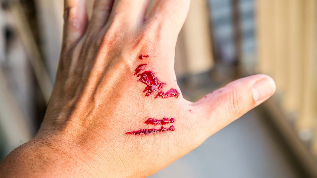 cho-khong-bi-dai-can-co-sao-khong (2).png