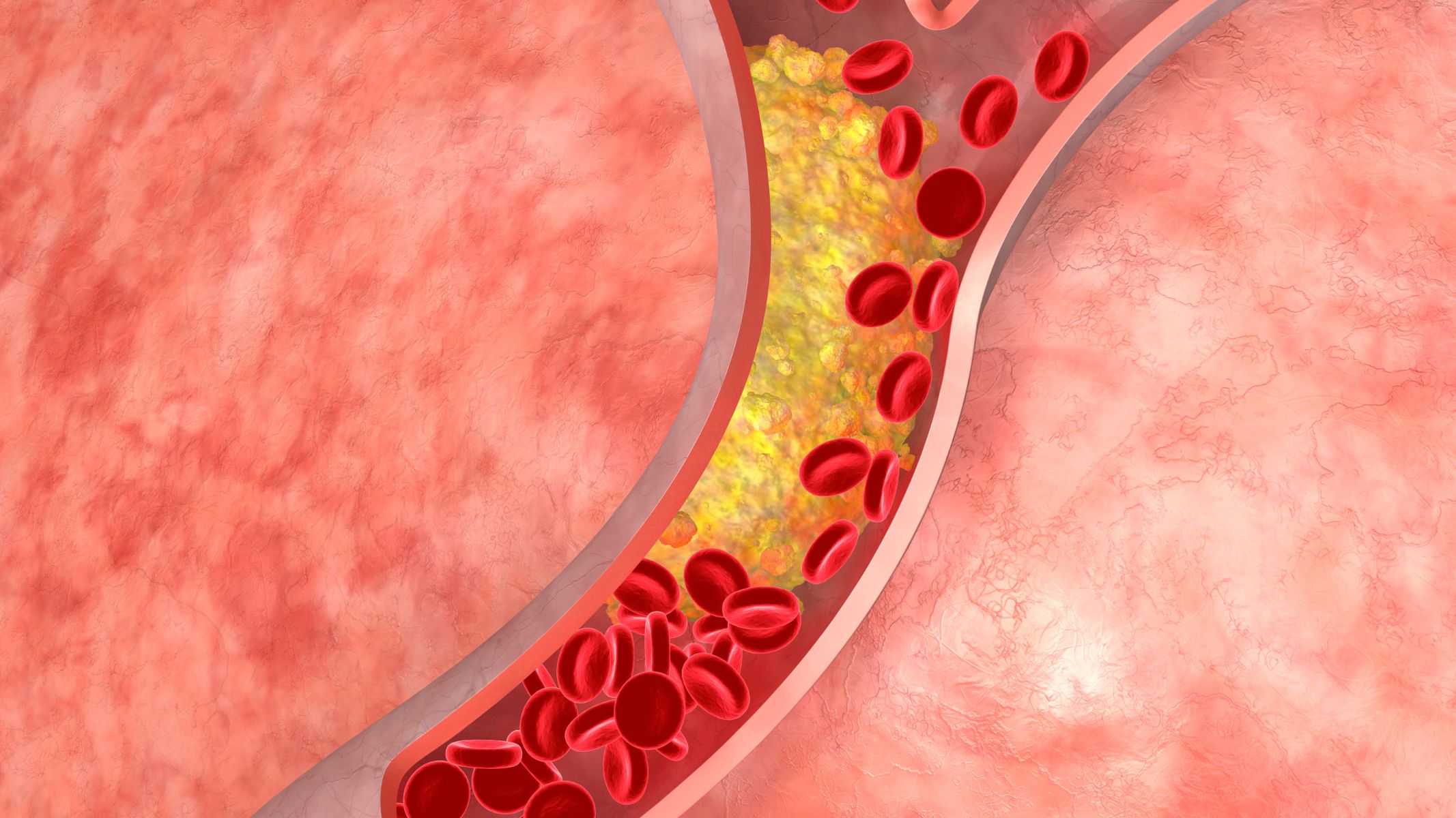 Cholesterol là thành phần thiết yếu của màng tế bào, giúp duy trì tính ổn định và linh hoạt của màng