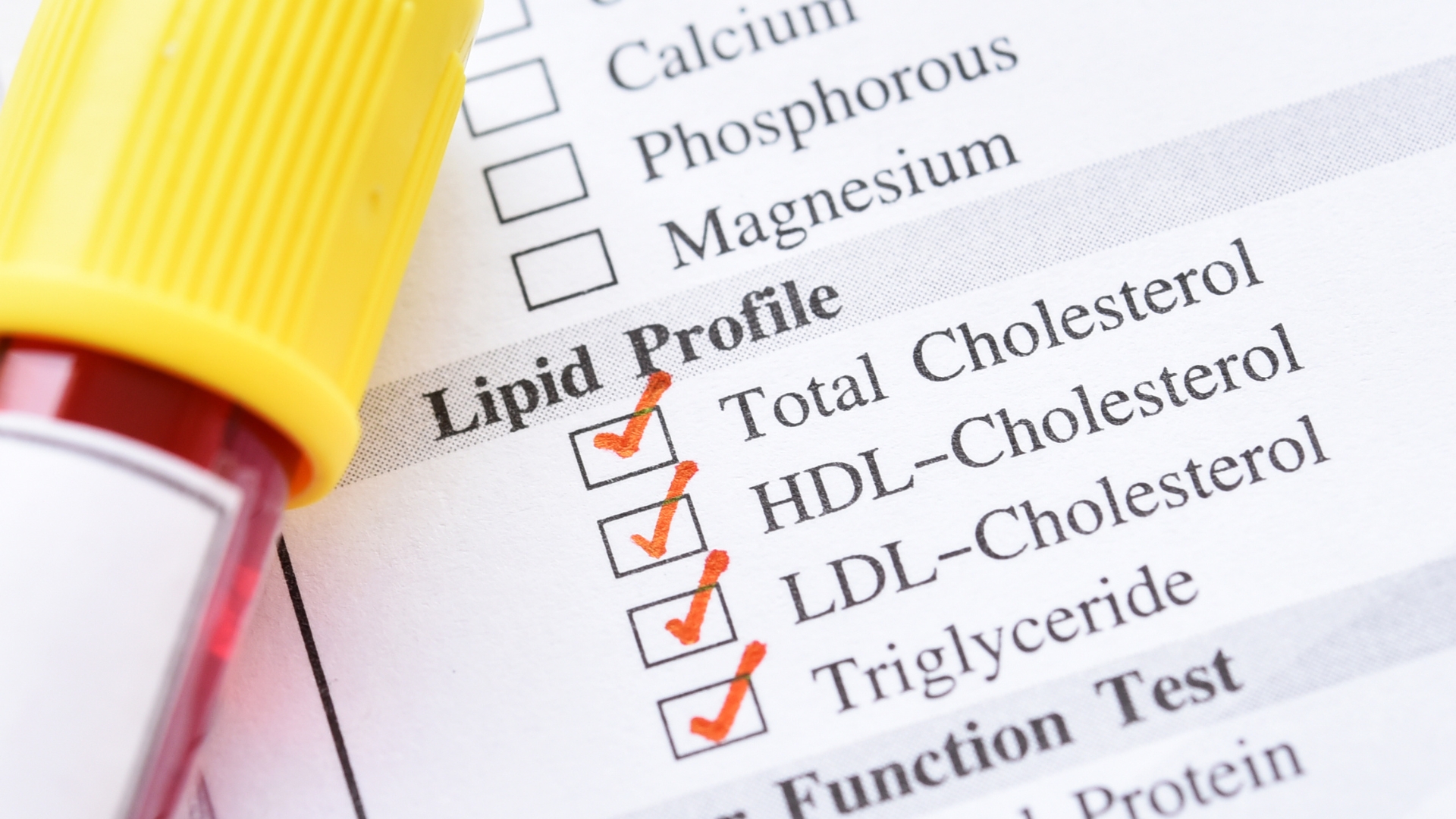 Cholesterol toàn phần bao gồm ba thành phần chính