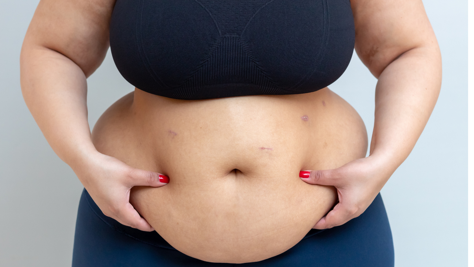 Chườm nóng có giảm mỡ bụng không? Câu trả lời là không