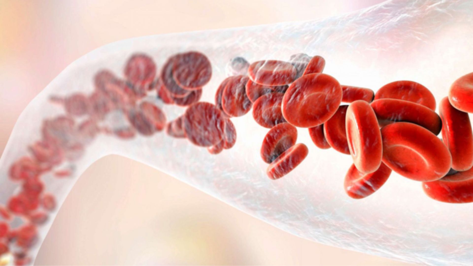 Chụp mạch máu số hóa xóa nền là tiêu chuẩn vàng trong chẩn đoán bệnh lý mạch máu