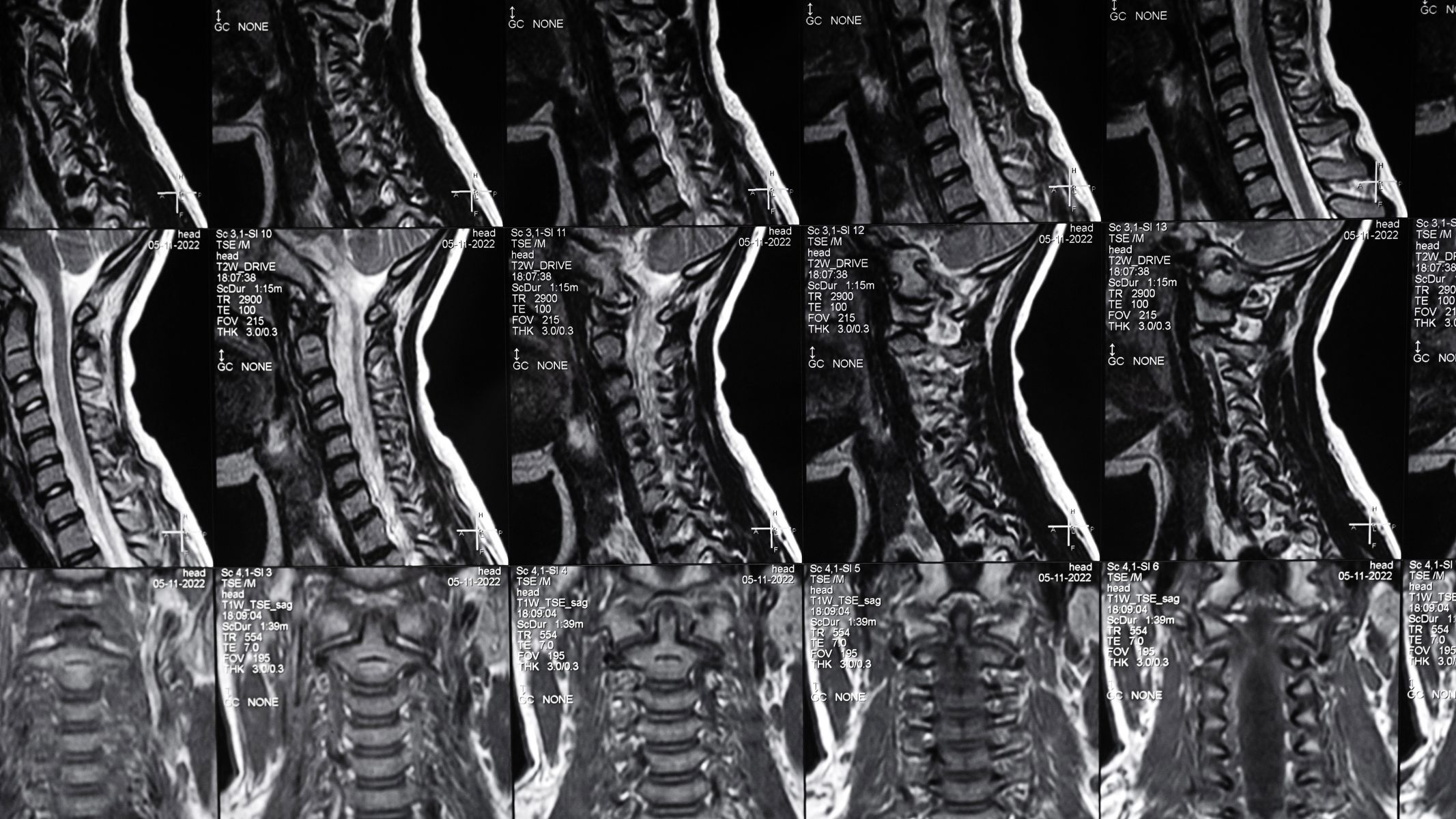 Phương pháp MRI có mức độ an toàn cao