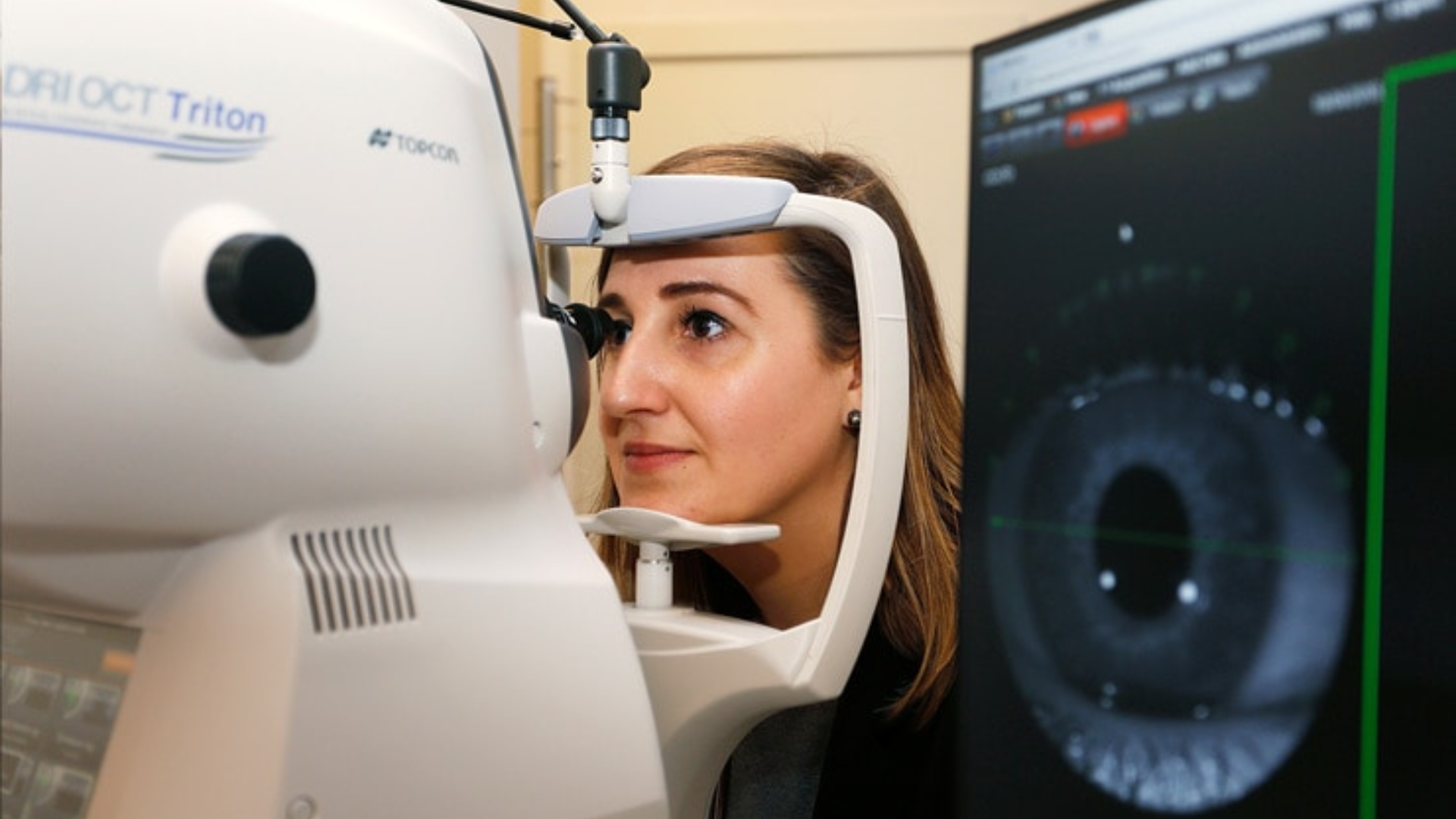 Việc chụp định kỳ có cần thiết hay không phụ thuộc vào tình trạng sức khỏe mắt của từng người