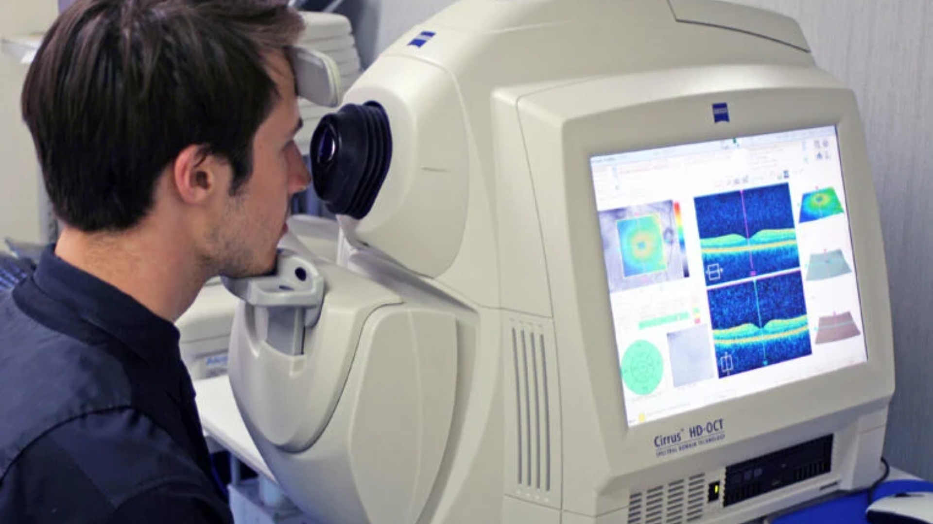 Chụp OCT mắt sử dụng sóng ánh sáng để tạo ra hình ảnh cắt lớp chi tiết của võng mạc và các cấu trúc trong mắt