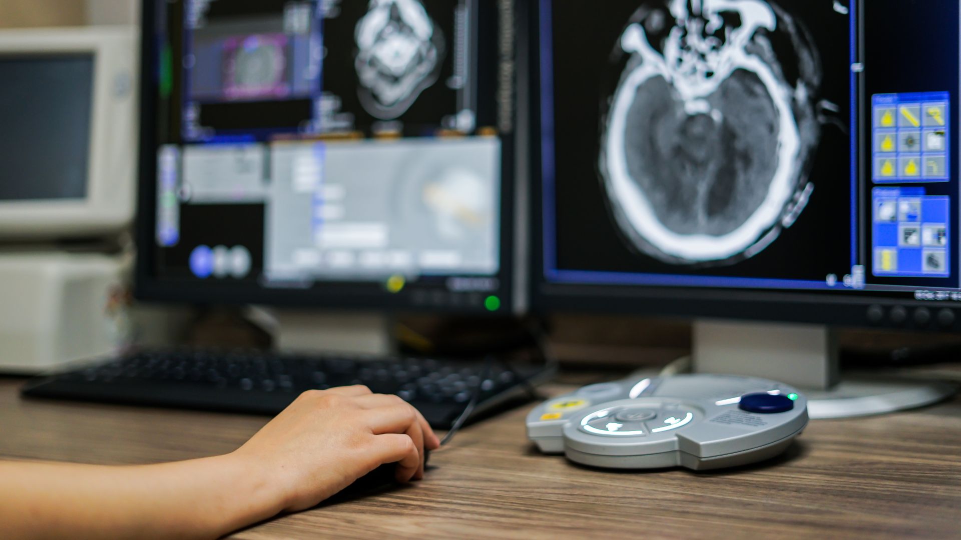 PET/CT là sự kết hợp cả hai kỹ thuật chẩn đoán hình ảnh trong một lần chụp