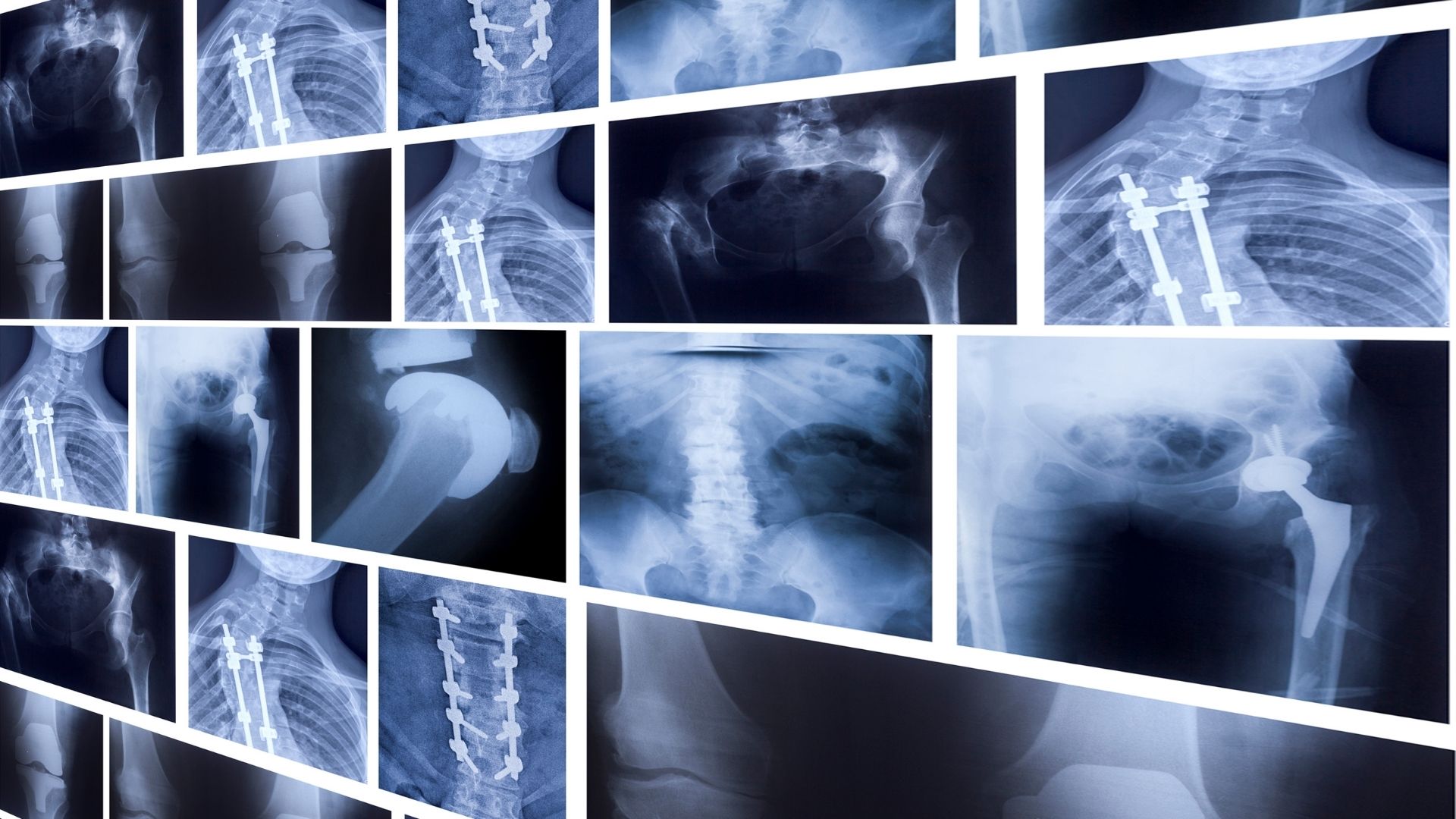 Chụp X- quang là một kỹ thuật chẩn đoán hình ảnh có sử dụng tia X