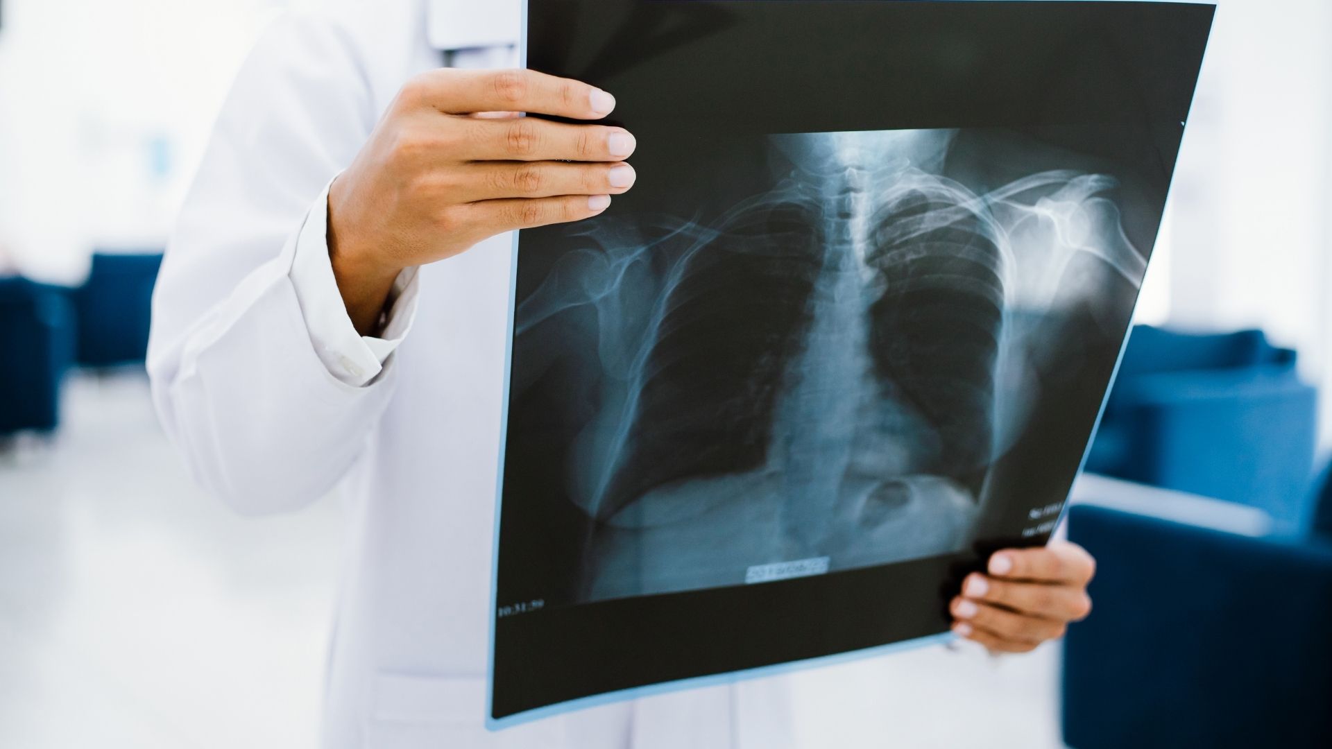 Chụp X-quang thường cho kết quả tương đối nhanh