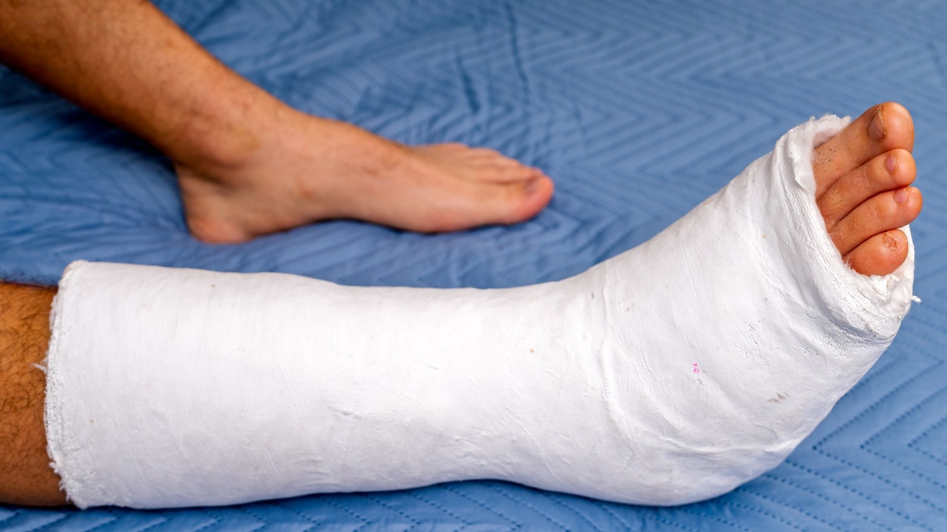 Chụp X-quang chân được chỉ định khi người bệnh bị chấn thương ở chân