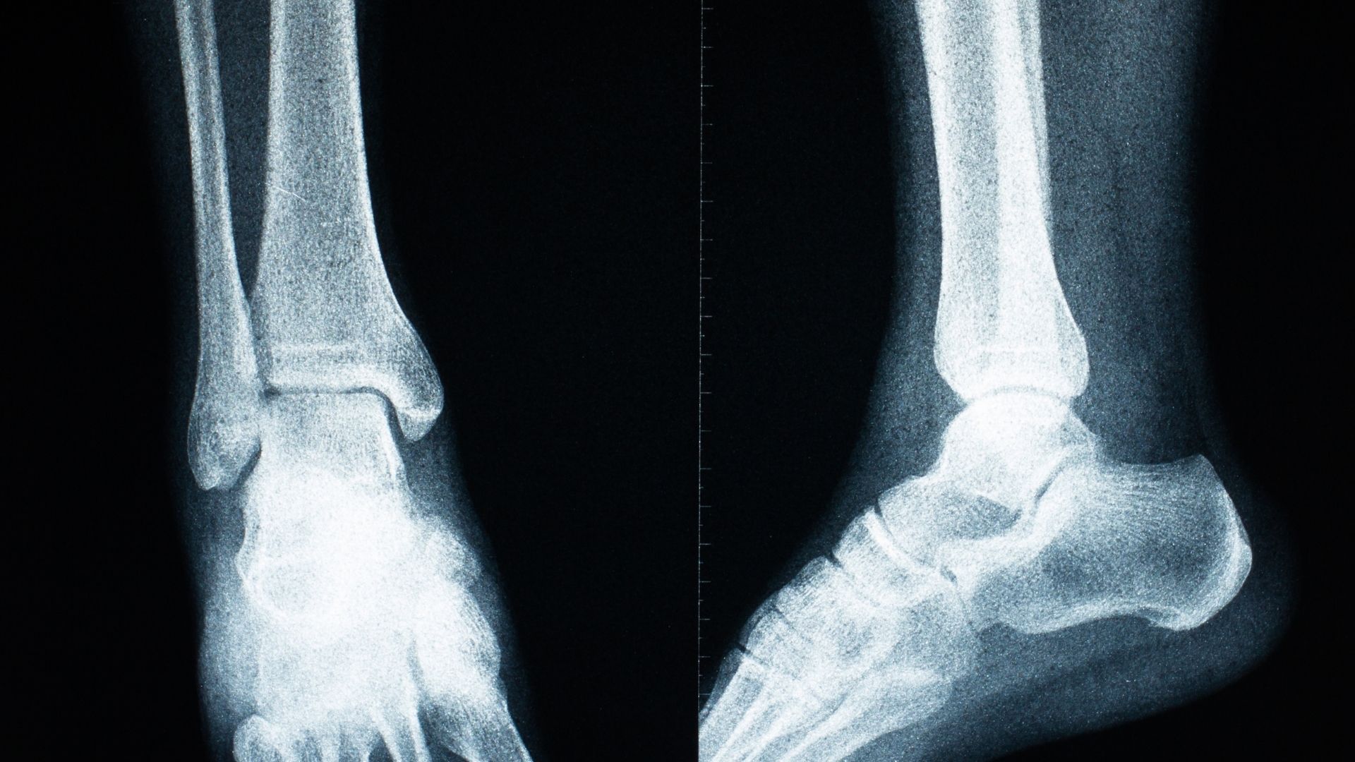 Chi phí chụp X-quang chân phụ thuộc vào nhiều yếu tố khác nhau