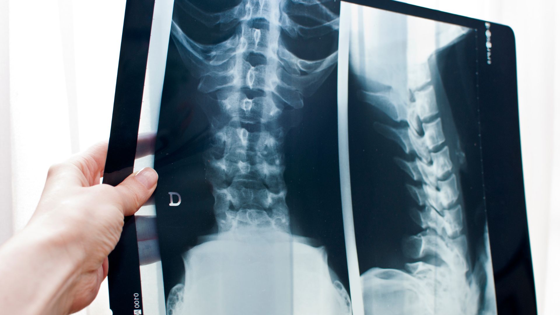 Người bệnh nên tuân thủ hướng dẫn của kỹ thuật viên để hạn chế nhiễu ảnh