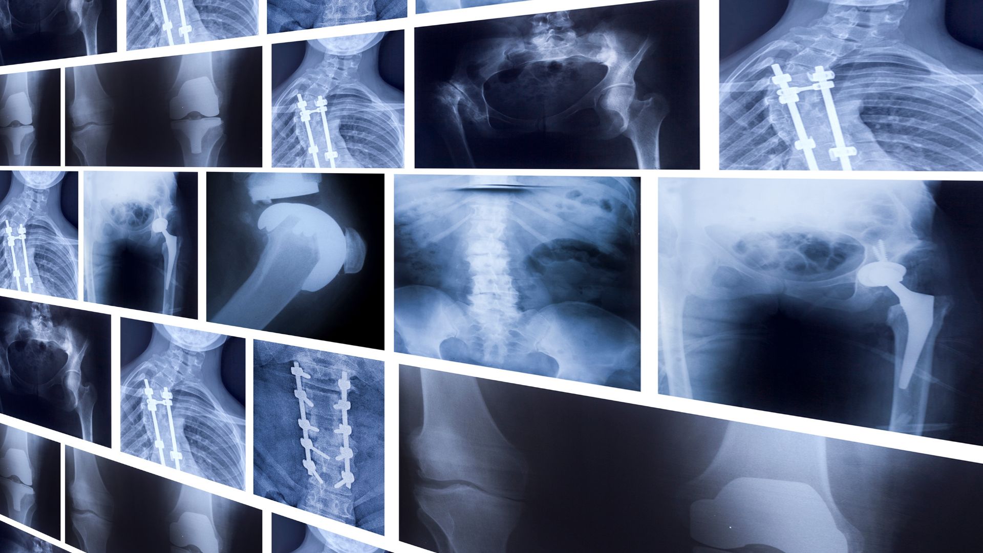 Chi phí chụp X-quang xương khớp còn phụ thuộc vào vị trí và số lượng vùng cần chụp