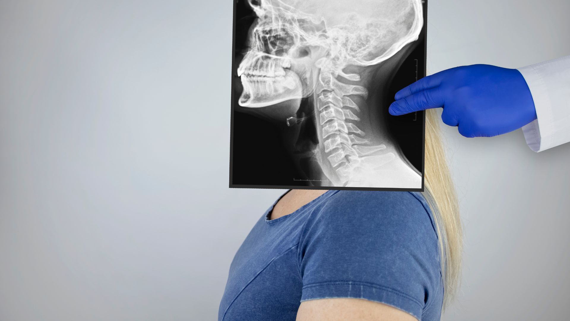 Người bệnh nên giữ nguyên tư thế trong vài giây khi chụp X-quang để hình ảnh thu được rõ nét và không bị mờ