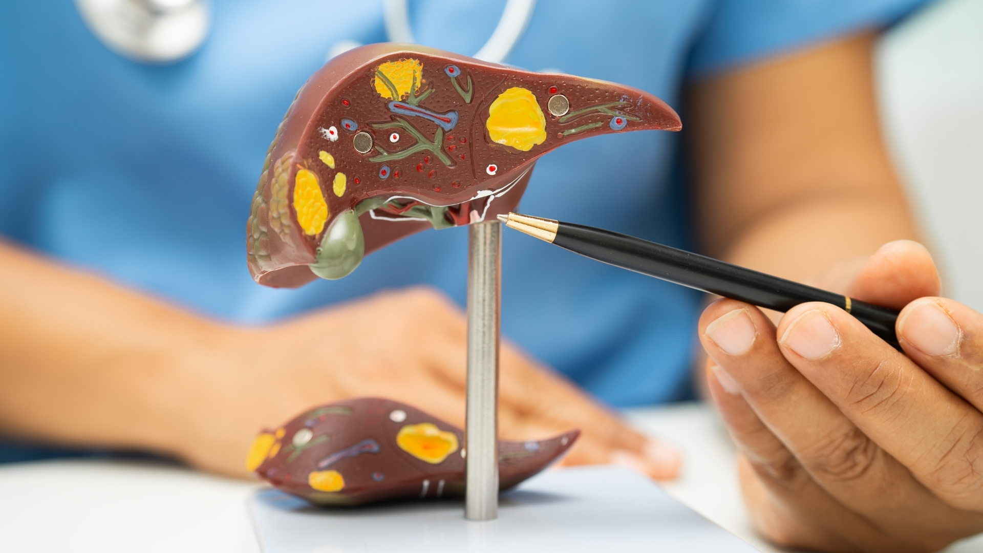 Chuyển dạng xoang hang tĩnh mạch cửa là biến đổi mạch máu xảy ra khi tĩnh mạch cửa dẫn máu về gan bị tắc nghẽn kéo dài