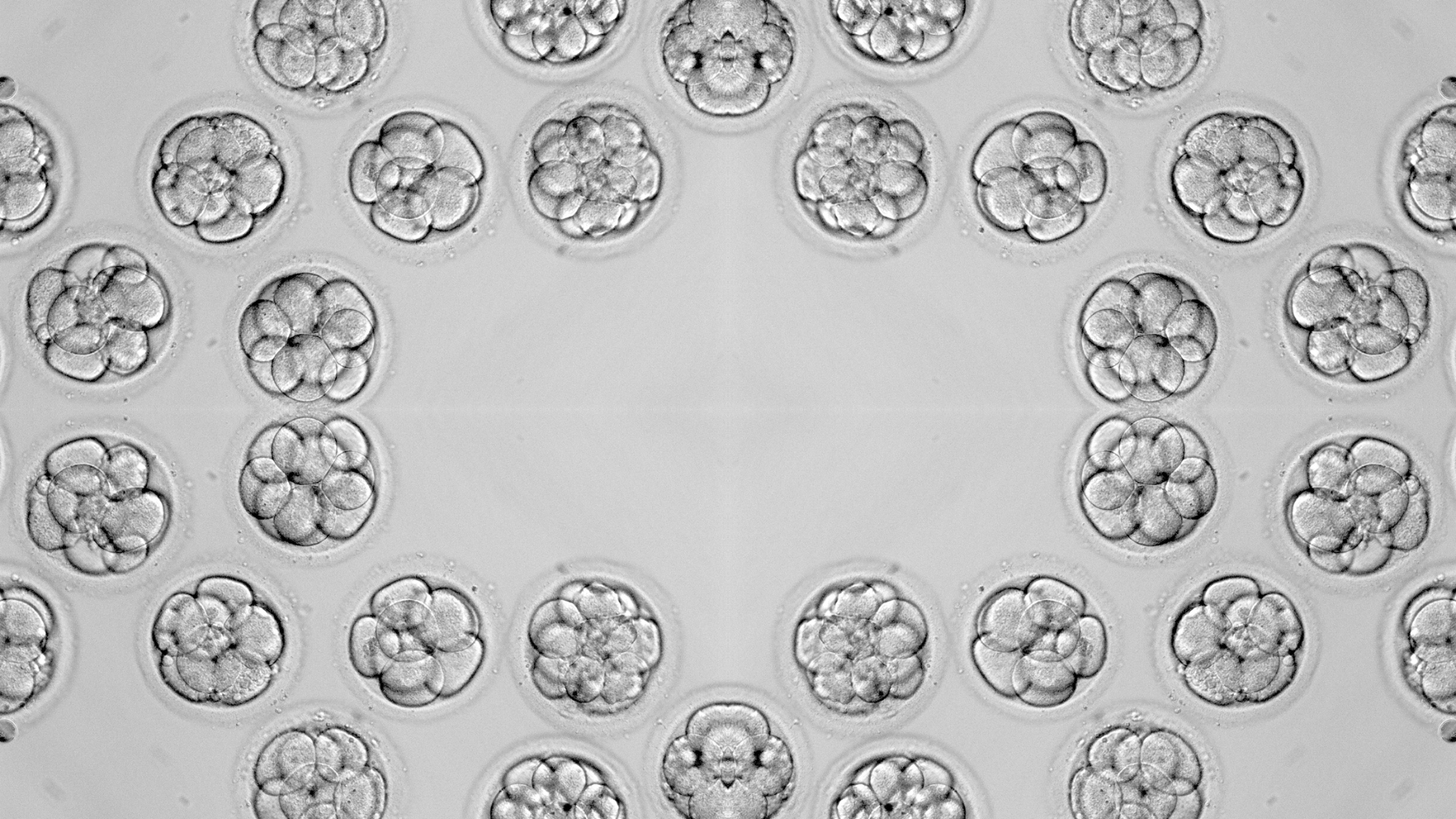 Chuyển phôi là một quy trình quan trọng trong kỹ thuật IVF