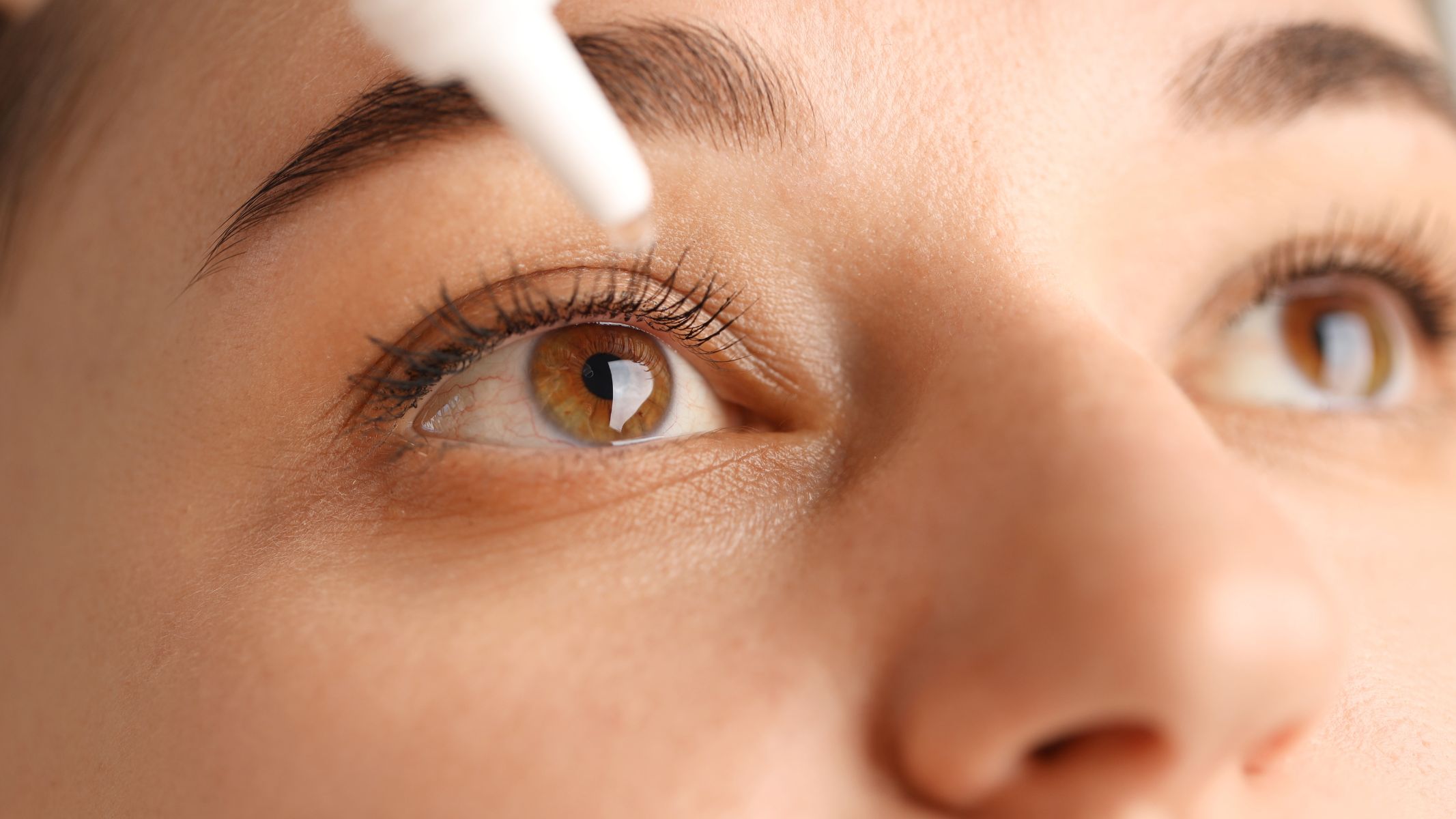 Trong các trường hợp co đồng tử liên quan đến viêm nhiễm, rối loạn điều tiết hoặc bệnh lý tại mắt, bác sĩ nhãn khoa có thể chỉ định thuốc nhỏ mắt giãn đồng tử